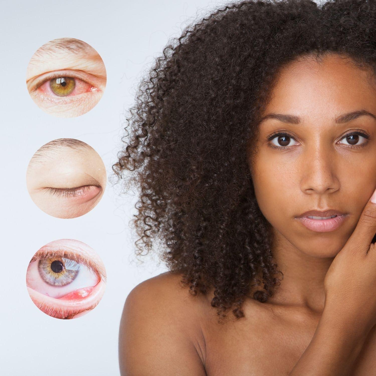 Alivio de Estilos brazzoMD - Fórmula con Árnica y Caléndula 29.57 ml