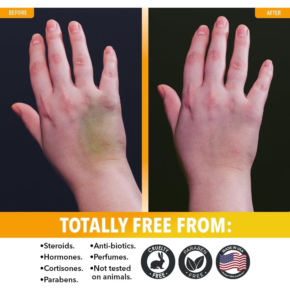 Gel de Árnica Montaña Dr. Robaina 113.4 g con MSM y Magnesio