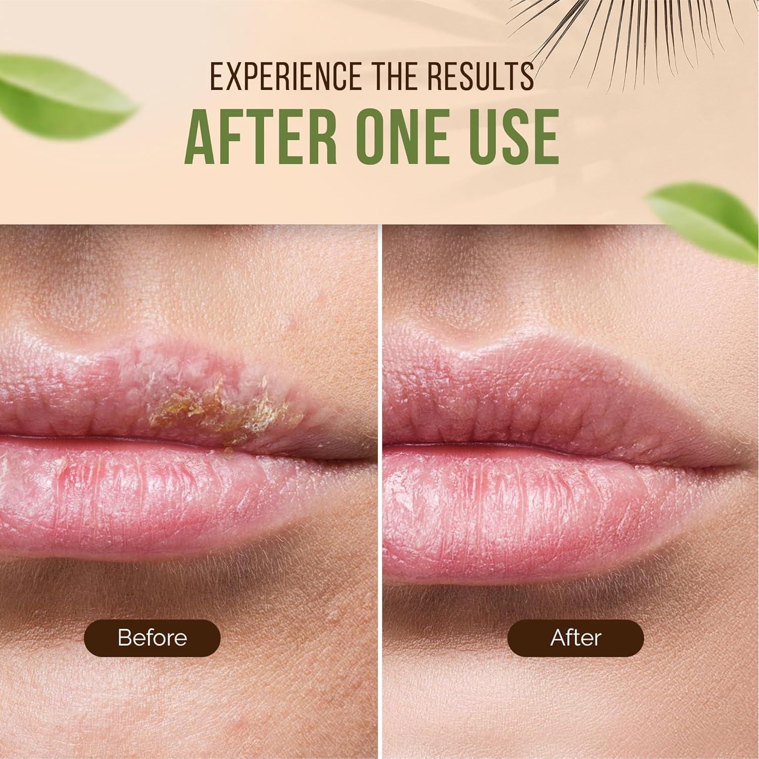 Ungüento Natural Teliaoils Bálamo de Limón 50ml - Piel Irritada