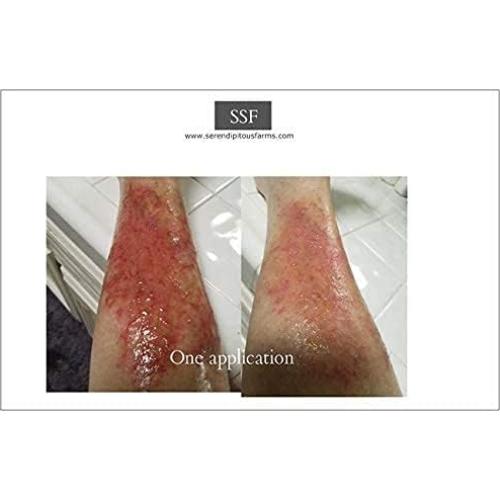 Ungüento Herbal de Consuelda Orgánica SSF 113g - Sanación Rápida