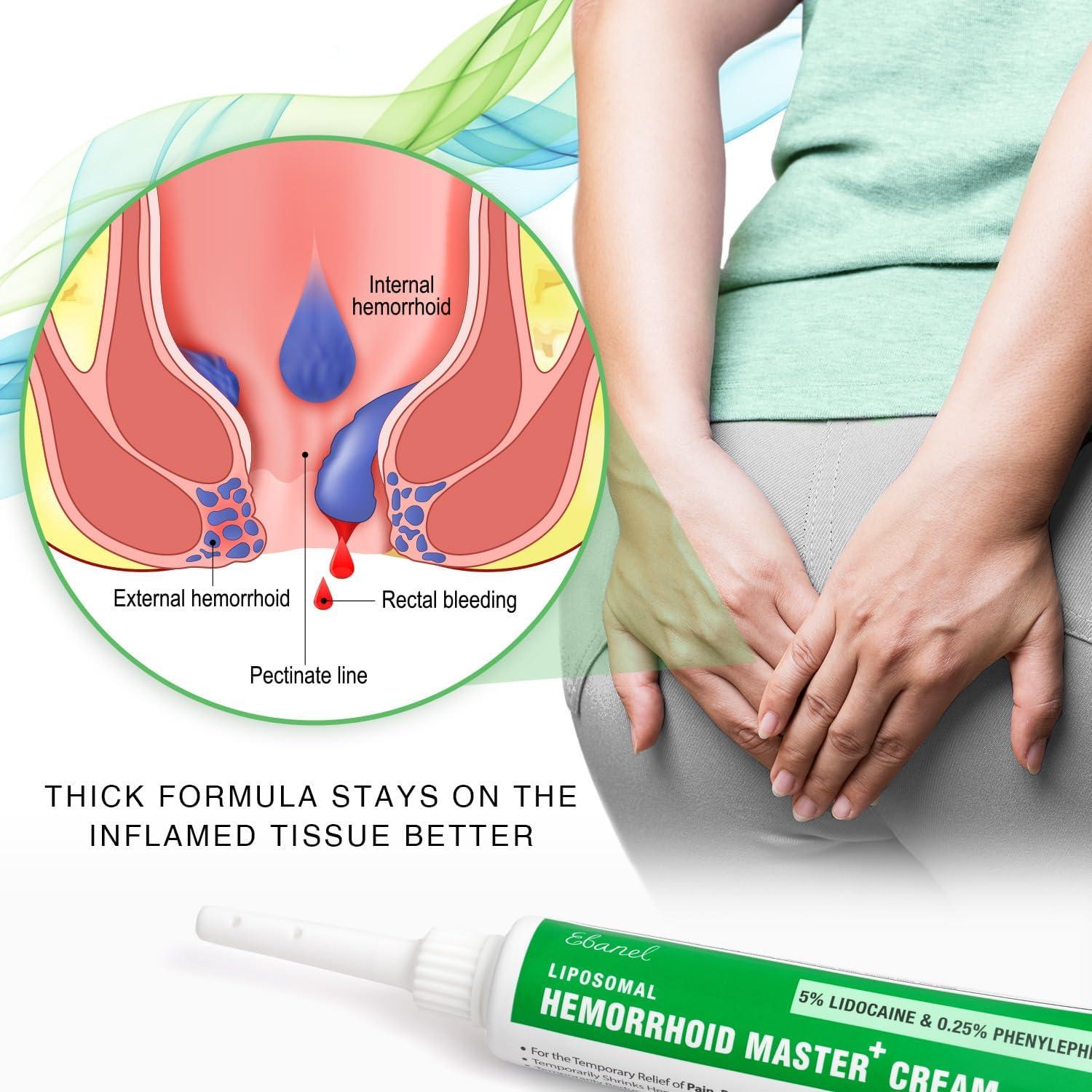Crema para Hemorroides Ebanel 5% Lidocaína 30g Alivio Rápido
