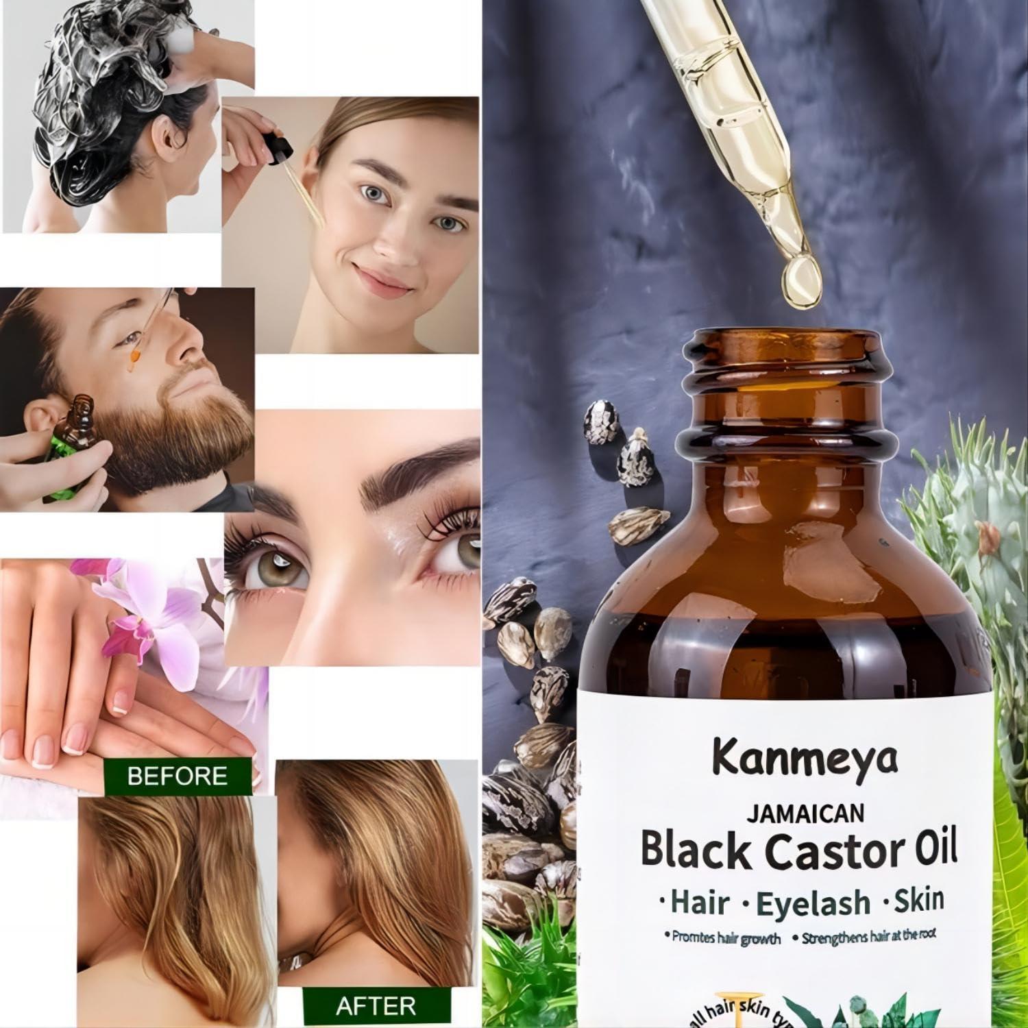 Aceite de Ricino Negro Jamaicano KIU-OIL 132g - Crecimiento Cabello y Piel