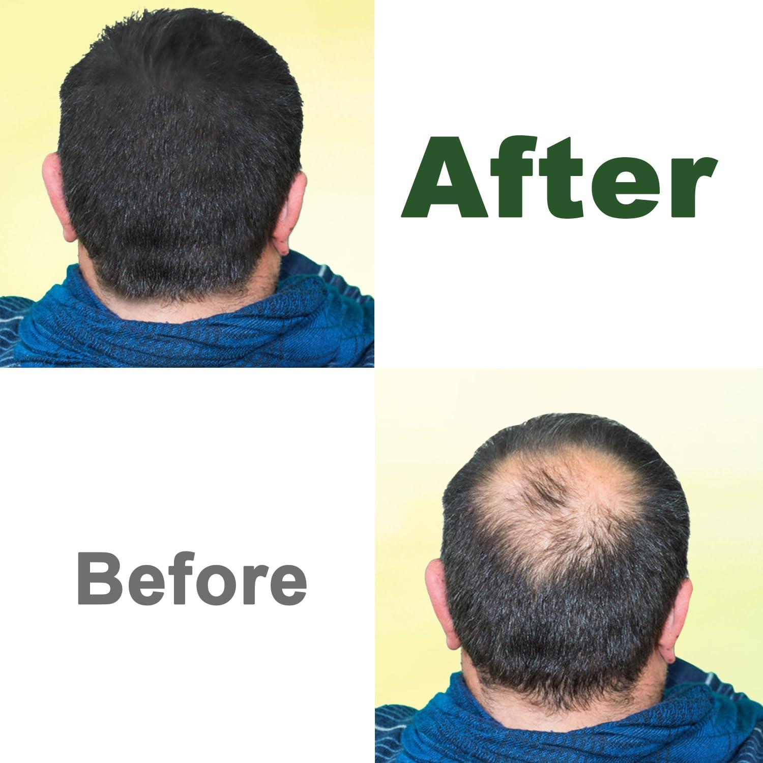 Aceite de Ricino Negro Orgánico GoldWorld 100% Puro 150ml