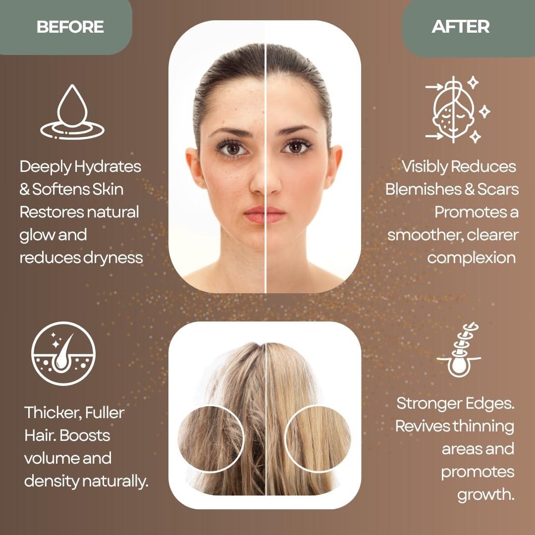 Aceite de Ricino Negro Jamaicano Orgánico Zelba 119 ml - Hidratante y Crecimiento Cabello