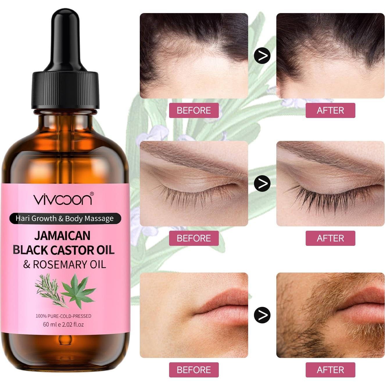 Aceite de Ricino Negro Orgánico Jamaicano Vivccon 132g