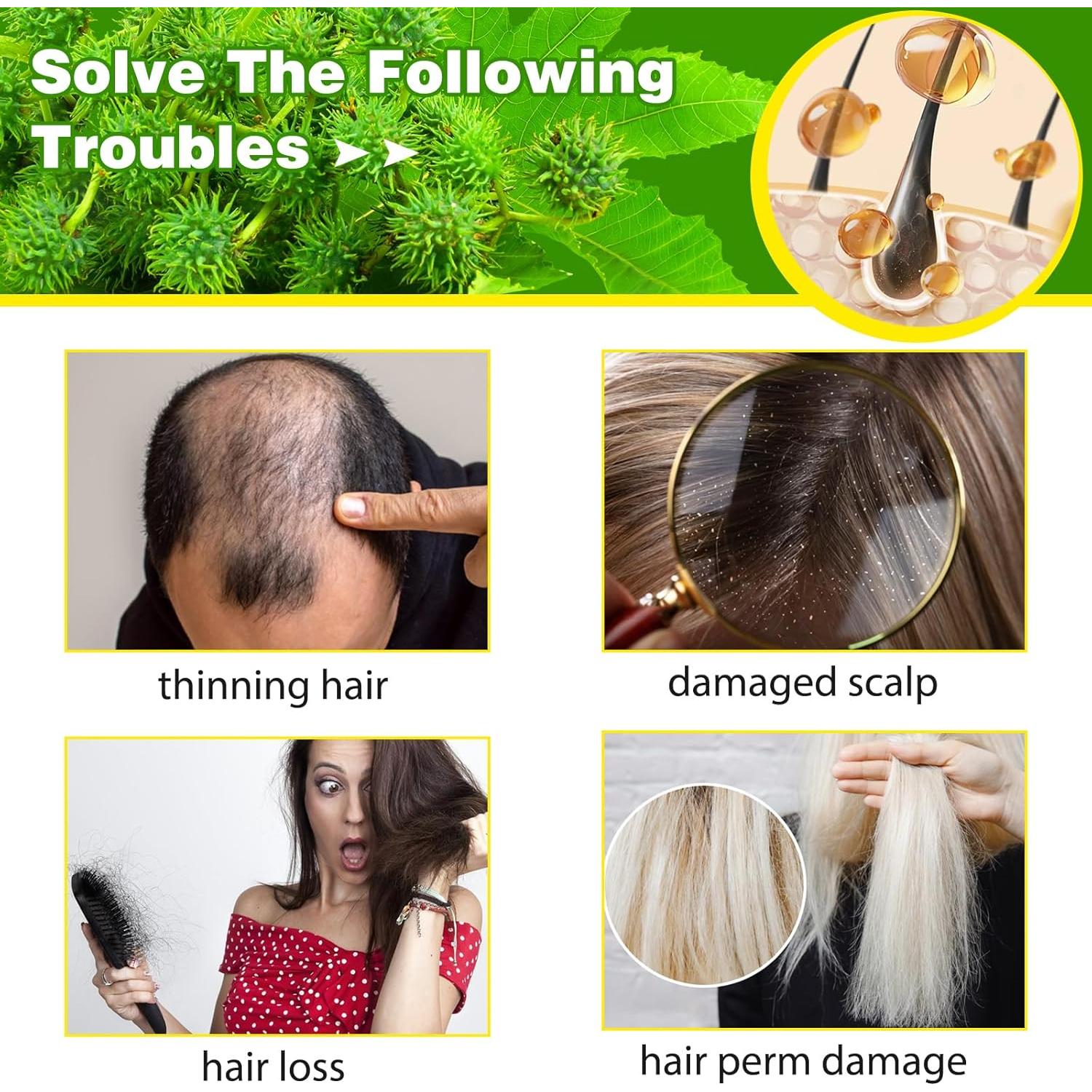 Aceite de Ricino Negro Jamaicano 60ml - Hidratante Natural Orgánico