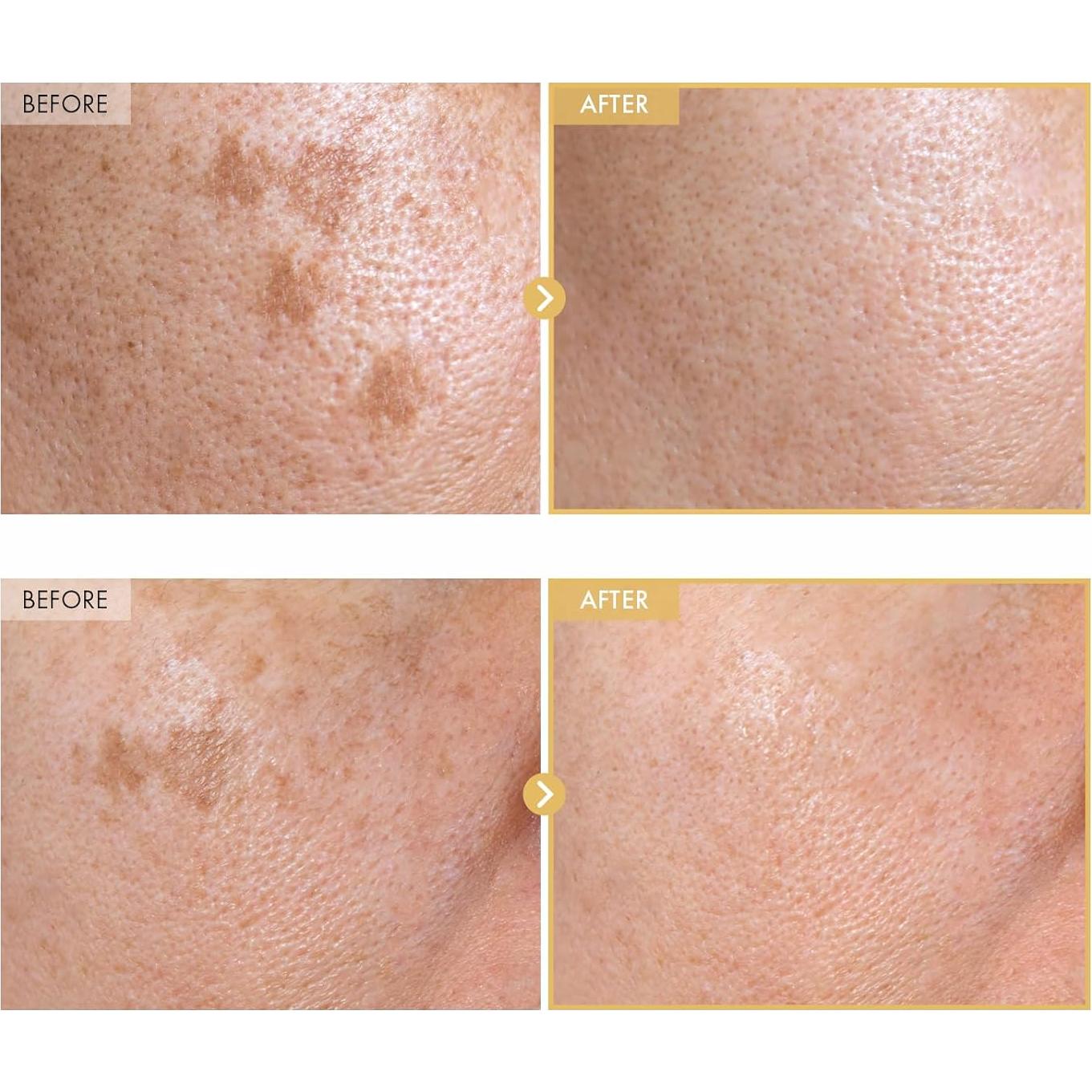 Suero Facial TOSOWOONG Ginseng de Caracol Negro 30ml Hidratante