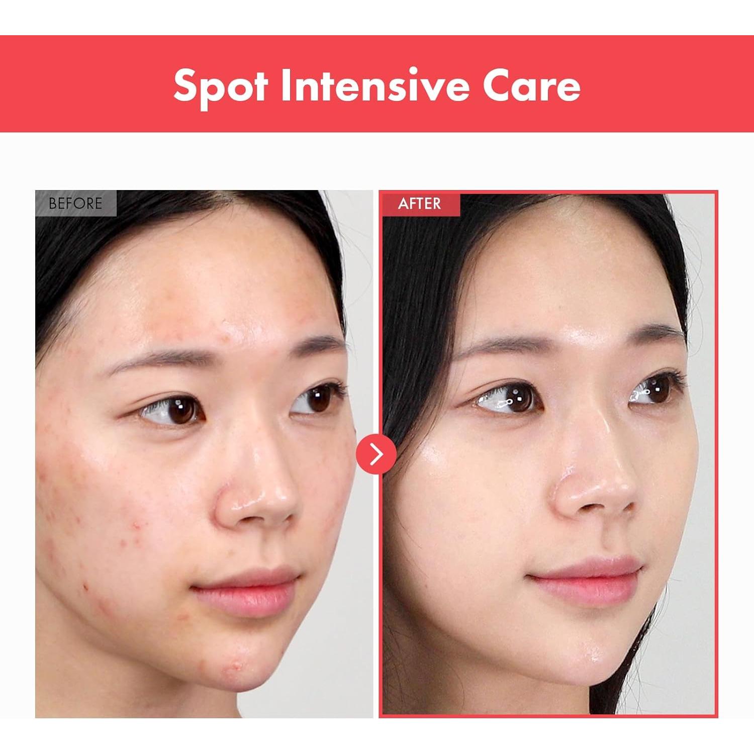 Crema Ovalicin MANTONG 50g - Hidratante Piel Clara con Niacinamida