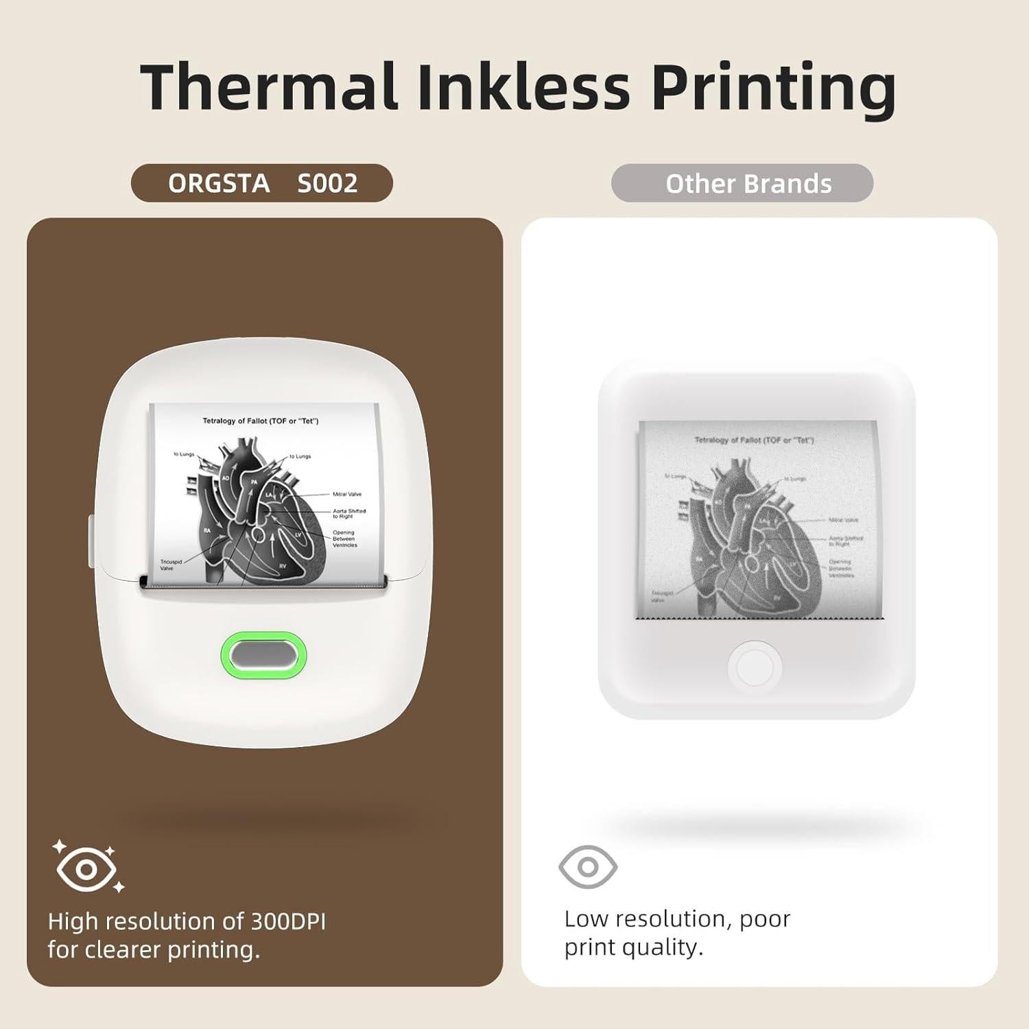 Impresora de Etiquetas Térmica ORGSTA S002 Bluetooth 300 DPI