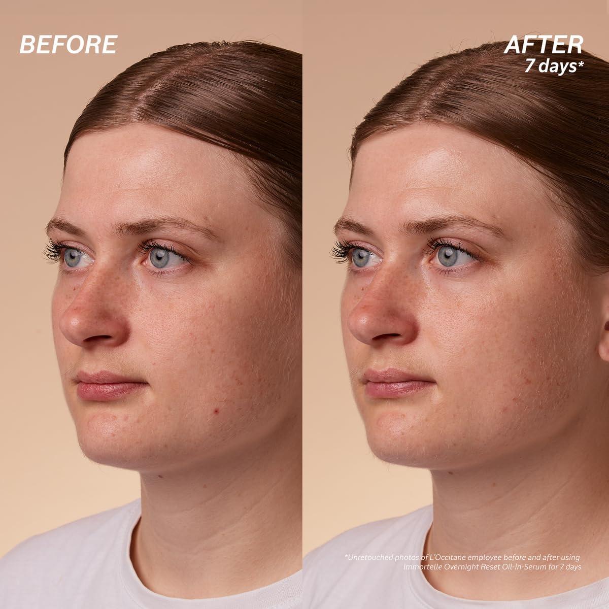 Suero Aceite En La Noche L'Occitane 29.57 ml Piel Radiante