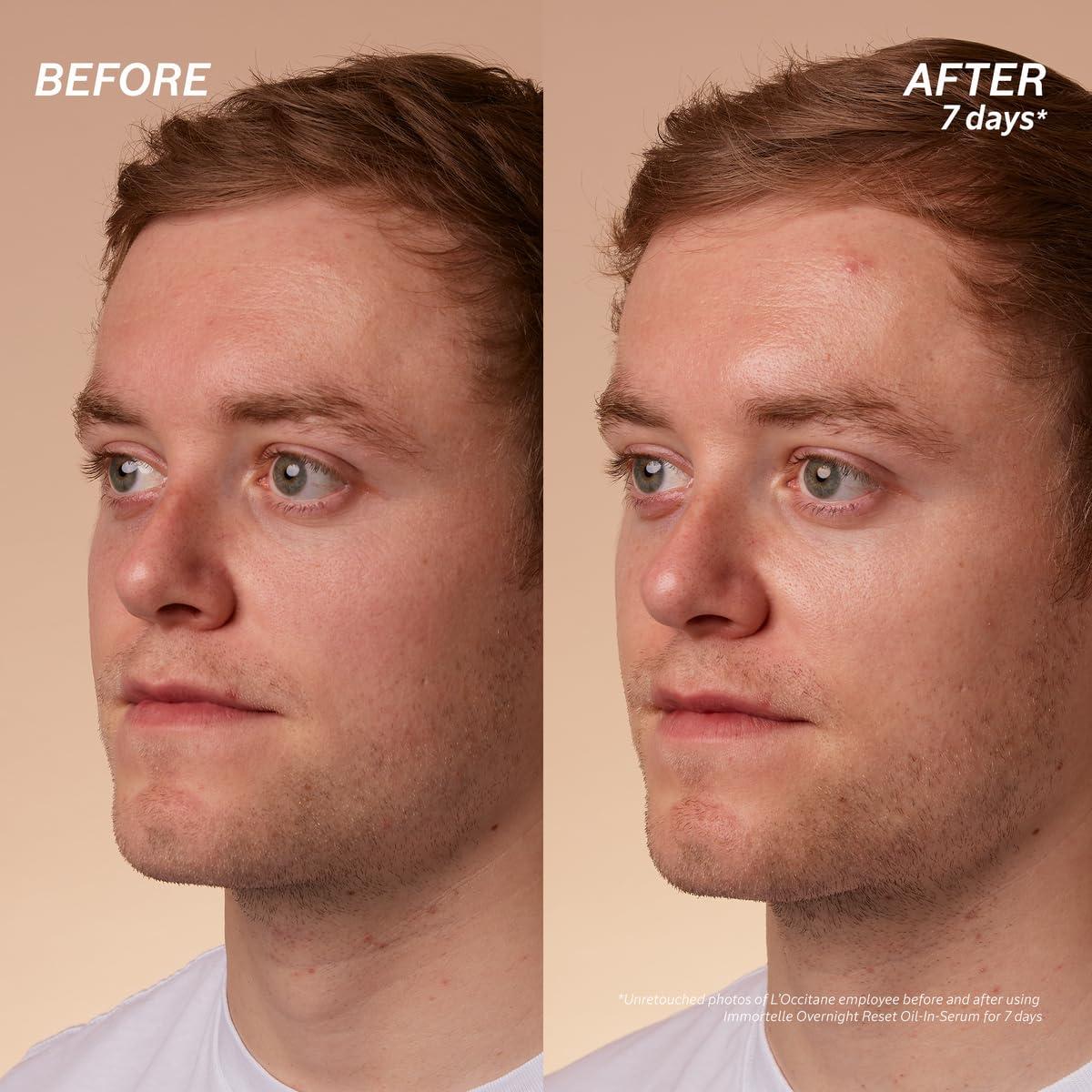 Suero Aceite En La Noche L'Occitane 29.57 ml Piel Radiante