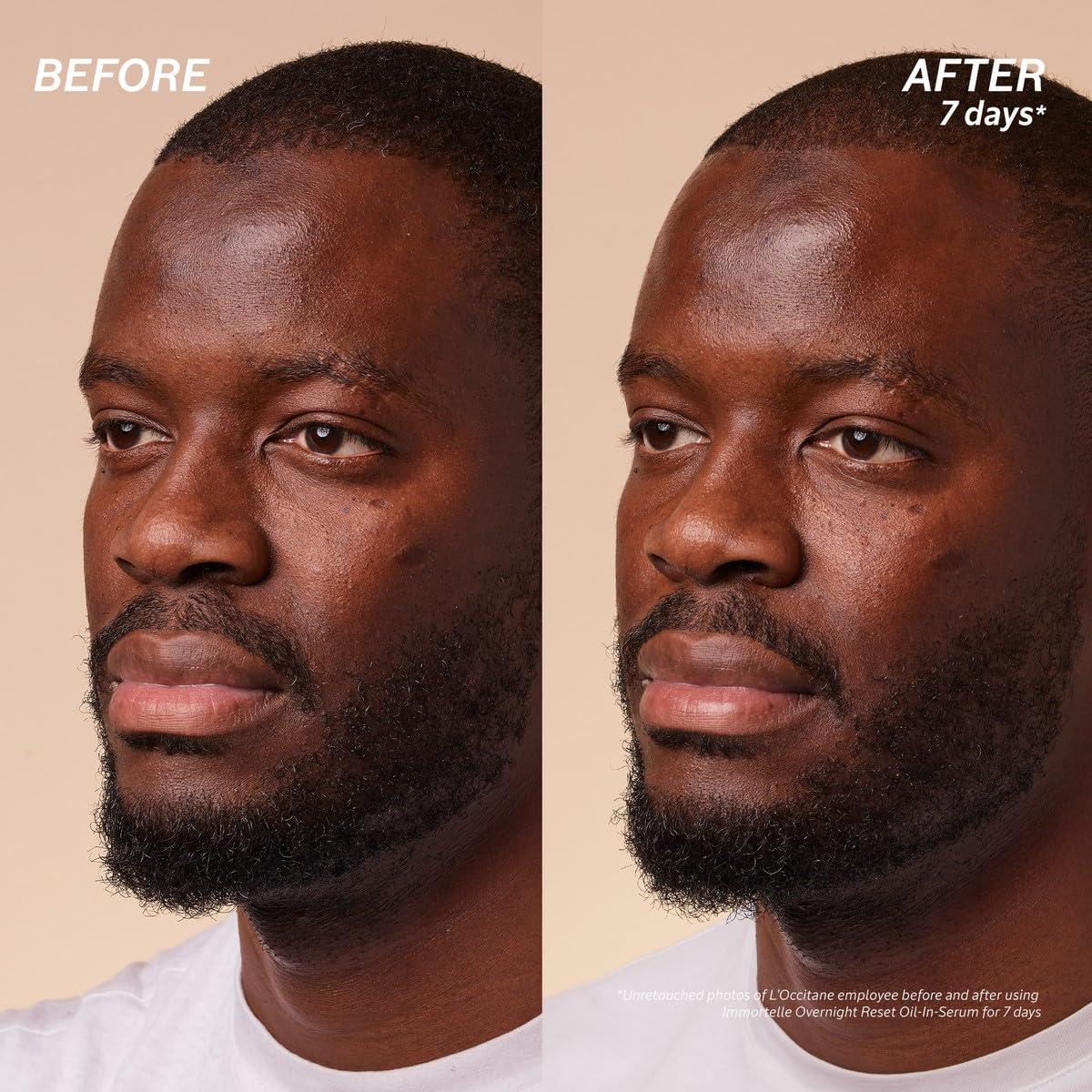 Suero Aceite En La Noche L'Occitane 29.57 ml Piel Radiante