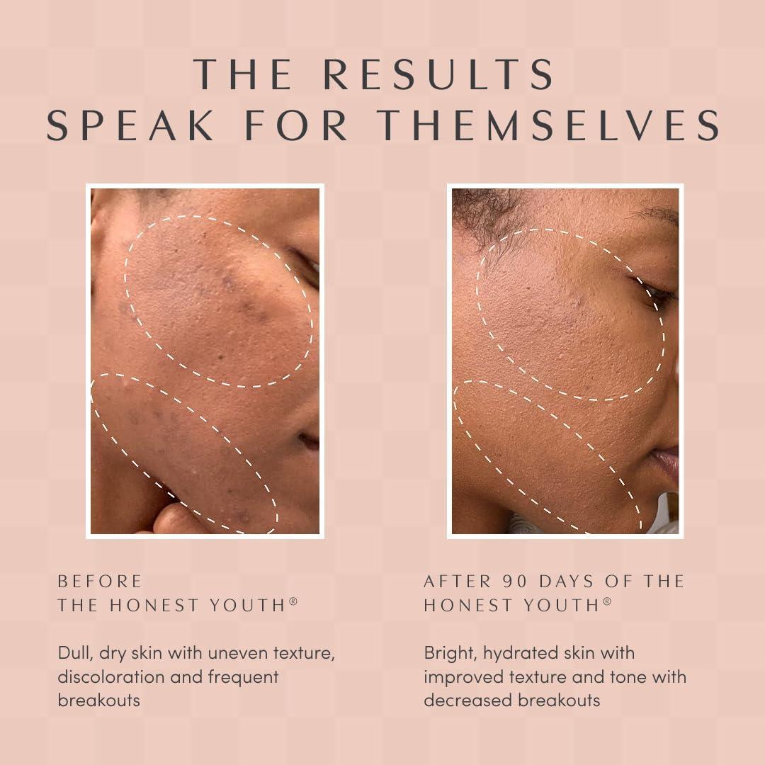 Gotas Herbales de Colágeno Apothékary 29.57 ml Veganas