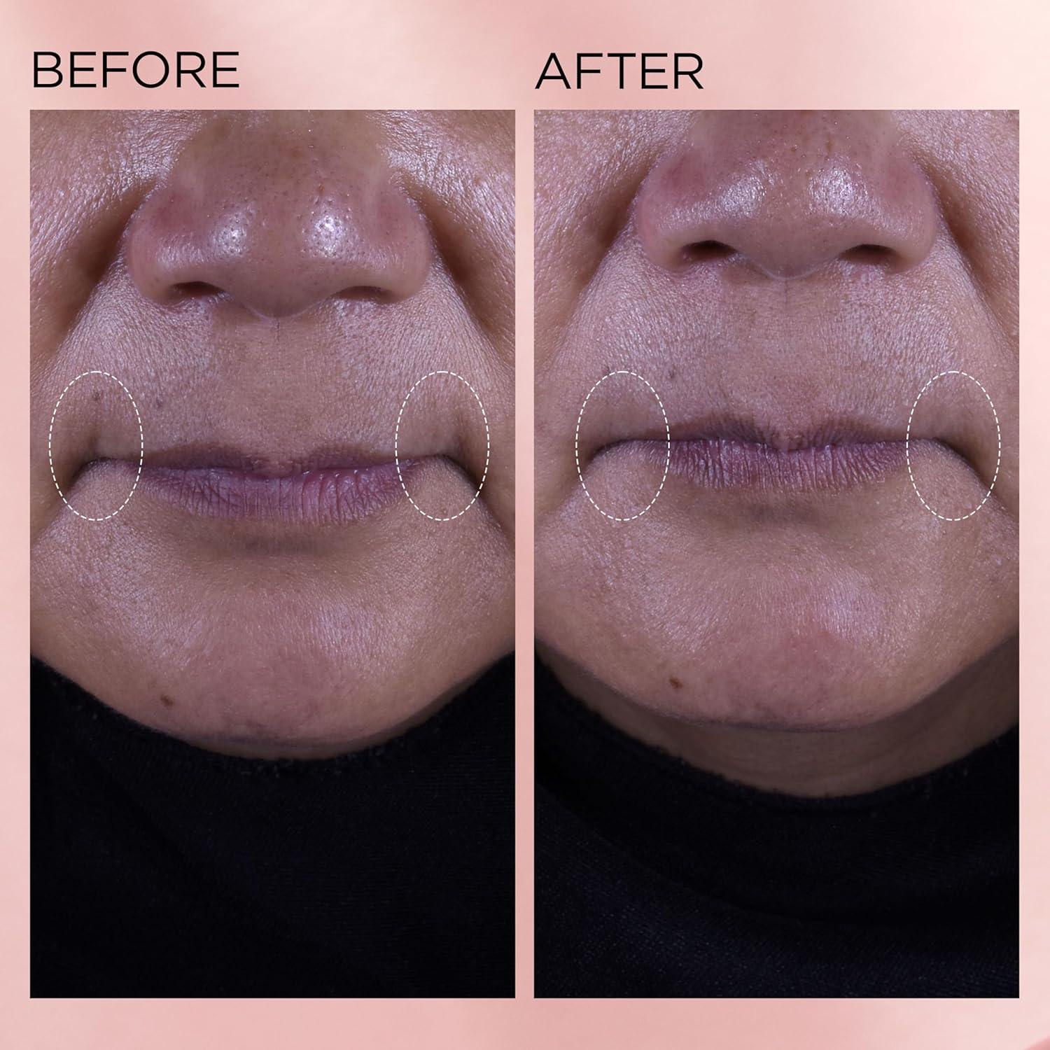 Crema Hidratante Facial Elizabeth Arden Retinol + HPR 50 ml