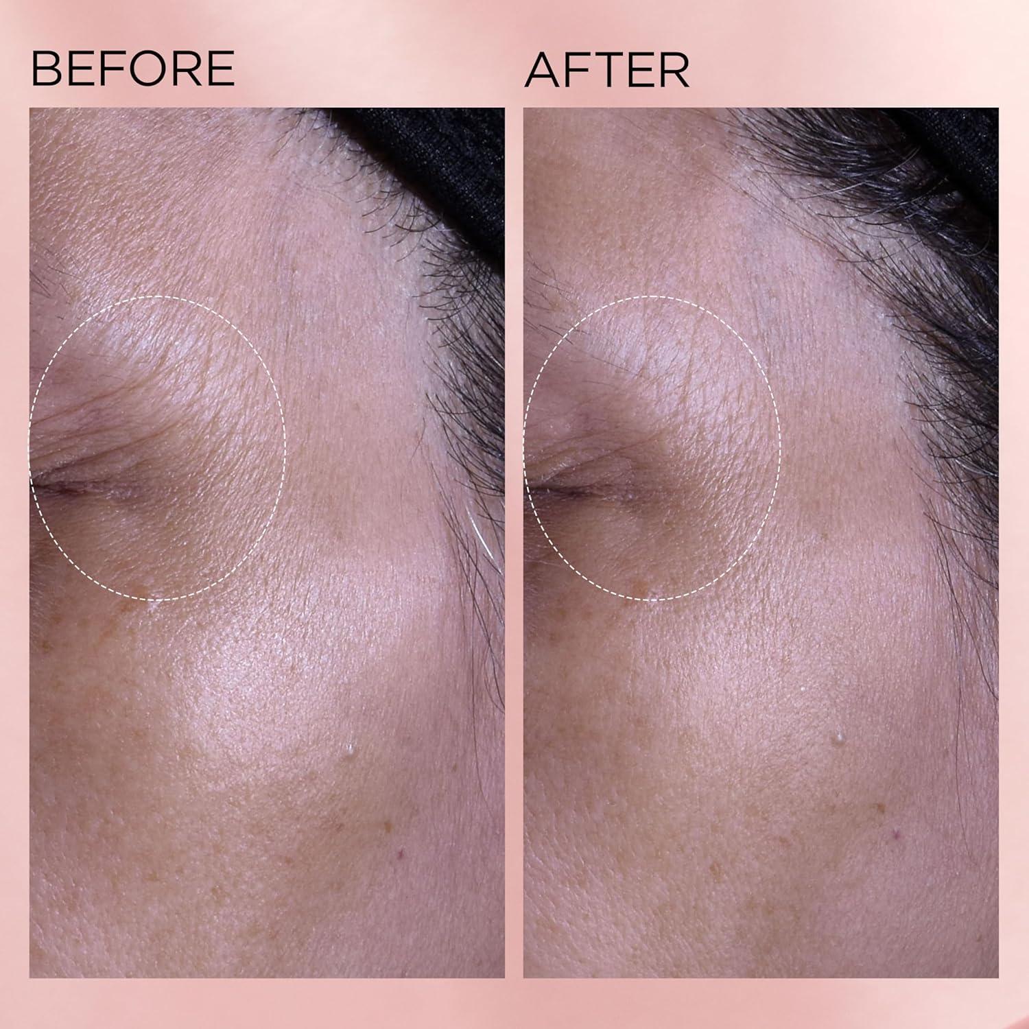 Crema Hidratante Facial Elizabeth Arden Retinol + HPR 50 ml