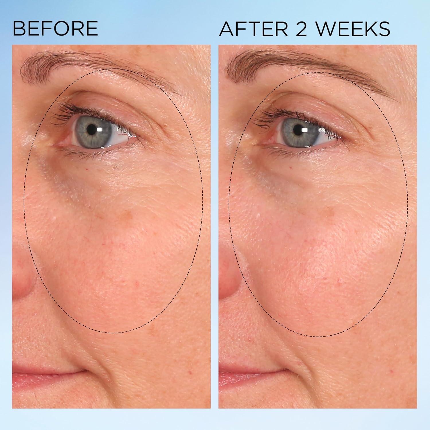 Cápsulas Correctoras de Manchas Elizabeth Arden 30 Unidades