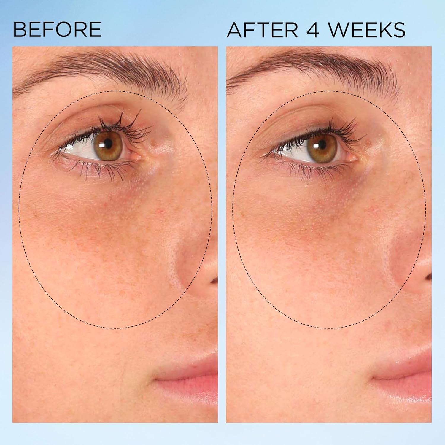 Cápsulas Correctoras de Manchas Elizabeth Arden 30 Unidades