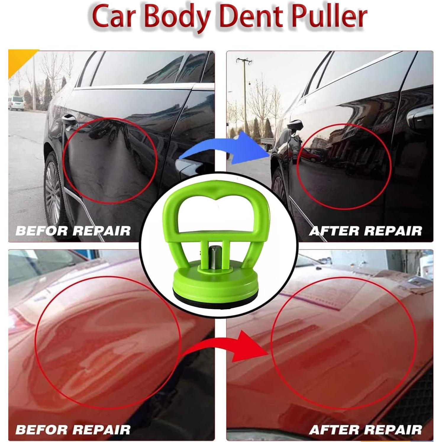 Ventosas de Alta Resistencia Unlimit - 5 Piezas para Reparación