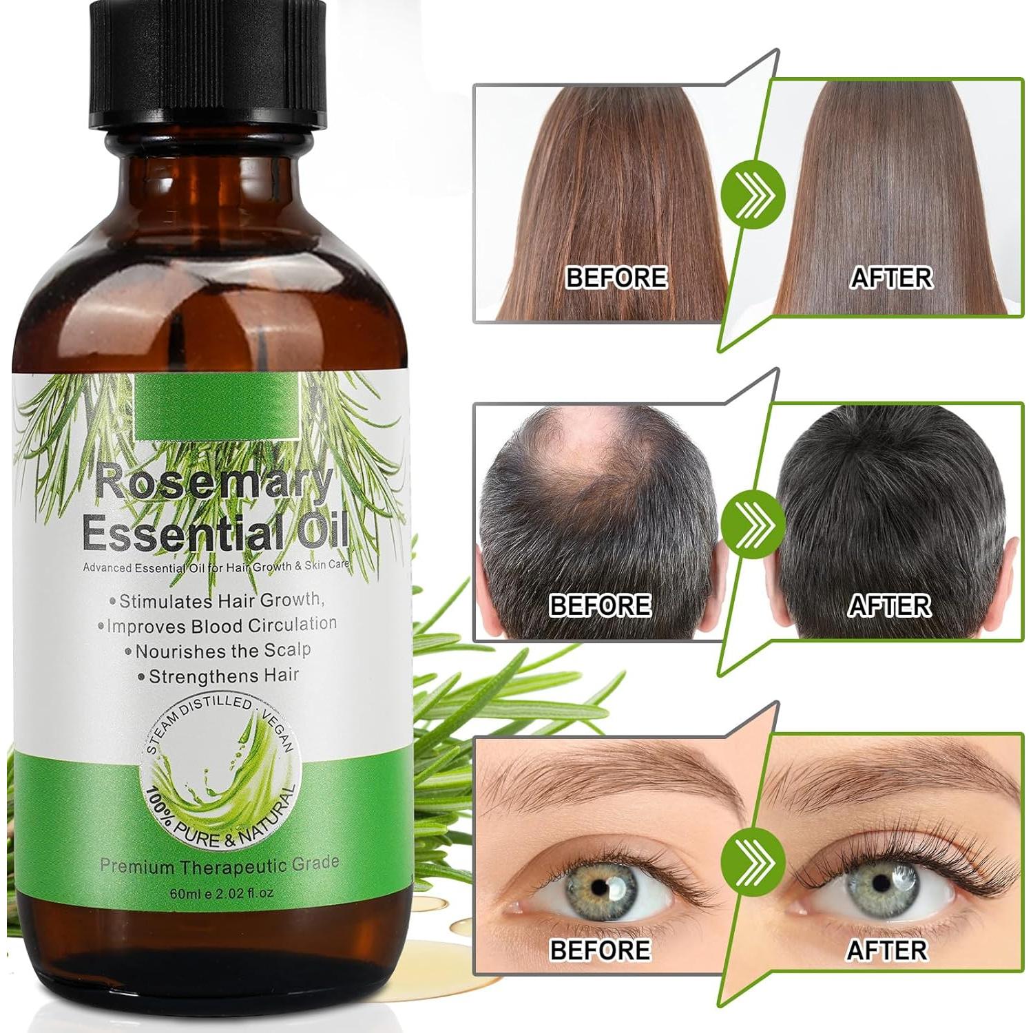 Aceite de Romero 100% Natural 59 ml para Crecimiento Cabello