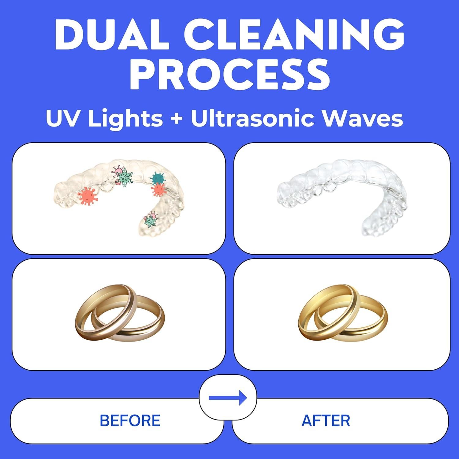 Limpiador Ultrasónico UV para Retenedores y Protectores Bucales - Hello Bright