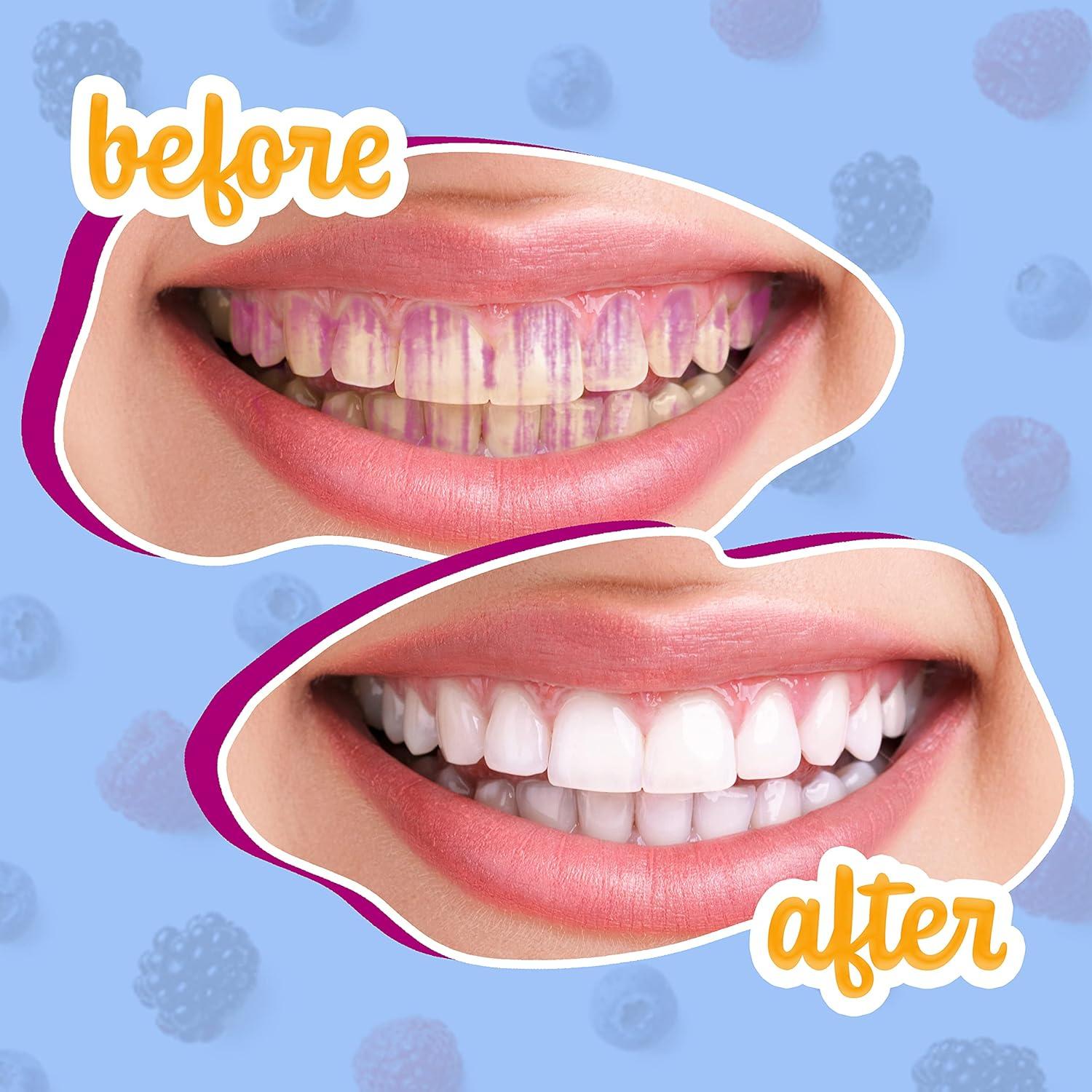 Tabletas de Revelado de Placa Lingito - 60 Piezas para Cuidado Oral