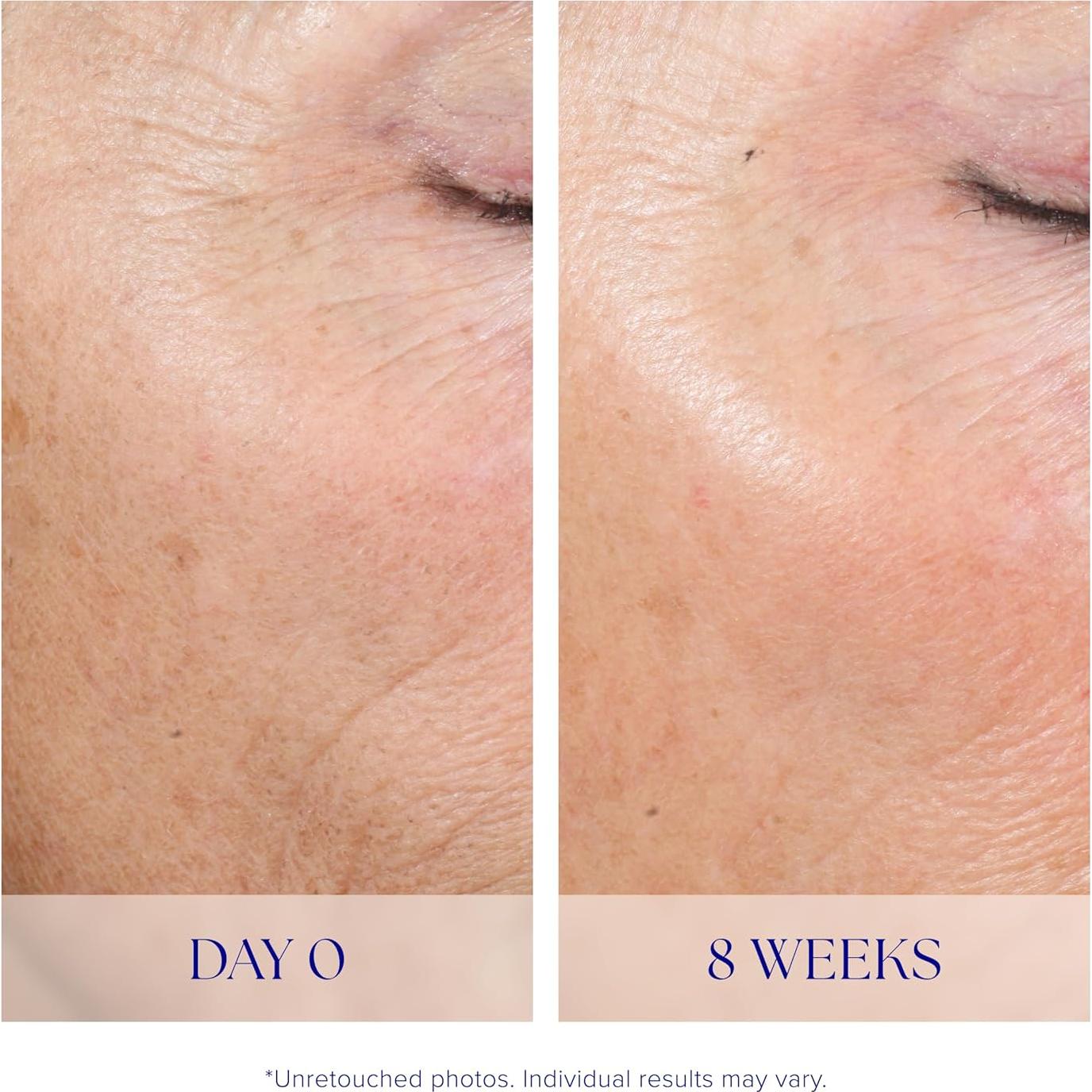 Sistema de Pelado Activo iS CLINICAL 2 Pasos Exfoliación Facial