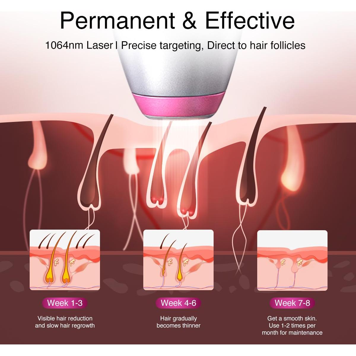 Depilación Láser Diodo DermRays 1064nm para Piel Oscura