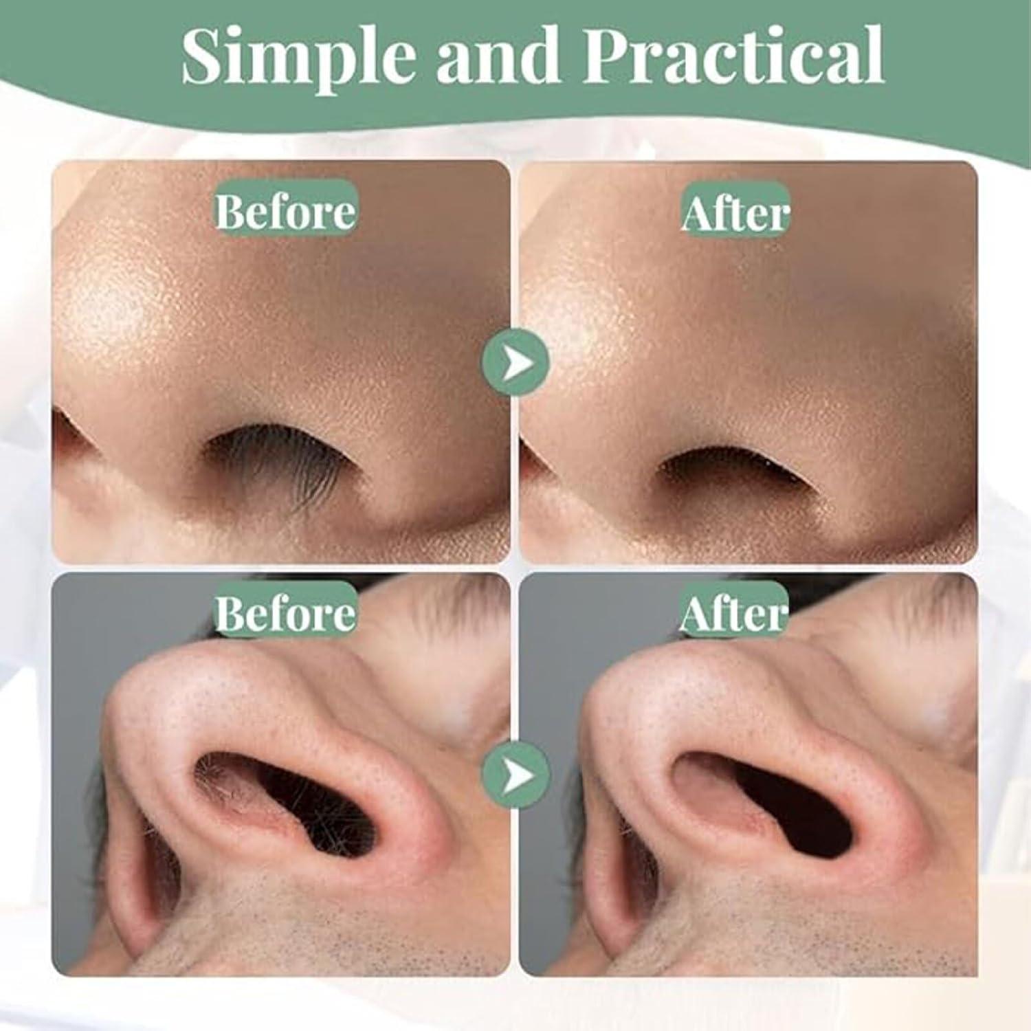 Recortador de Vello Nasal Manual 12 Piezas Calefow