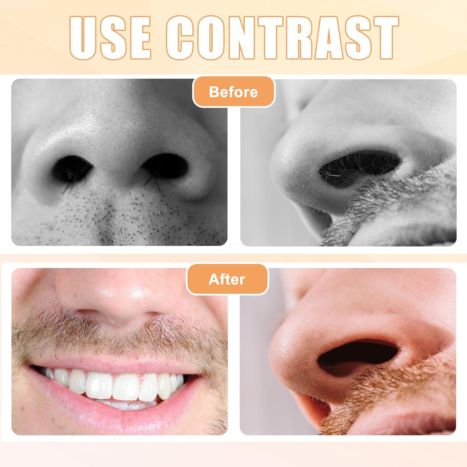 Recortador de Vello Nasal 2 en 1 Gosknor - 5 Piezas