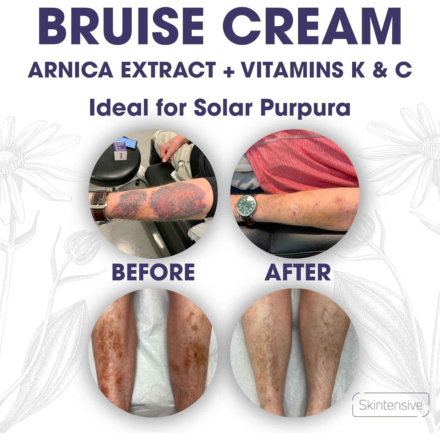 Crema Hidratante Skintensive con Árnica y Vitaminas K, C, E - 113.4 g