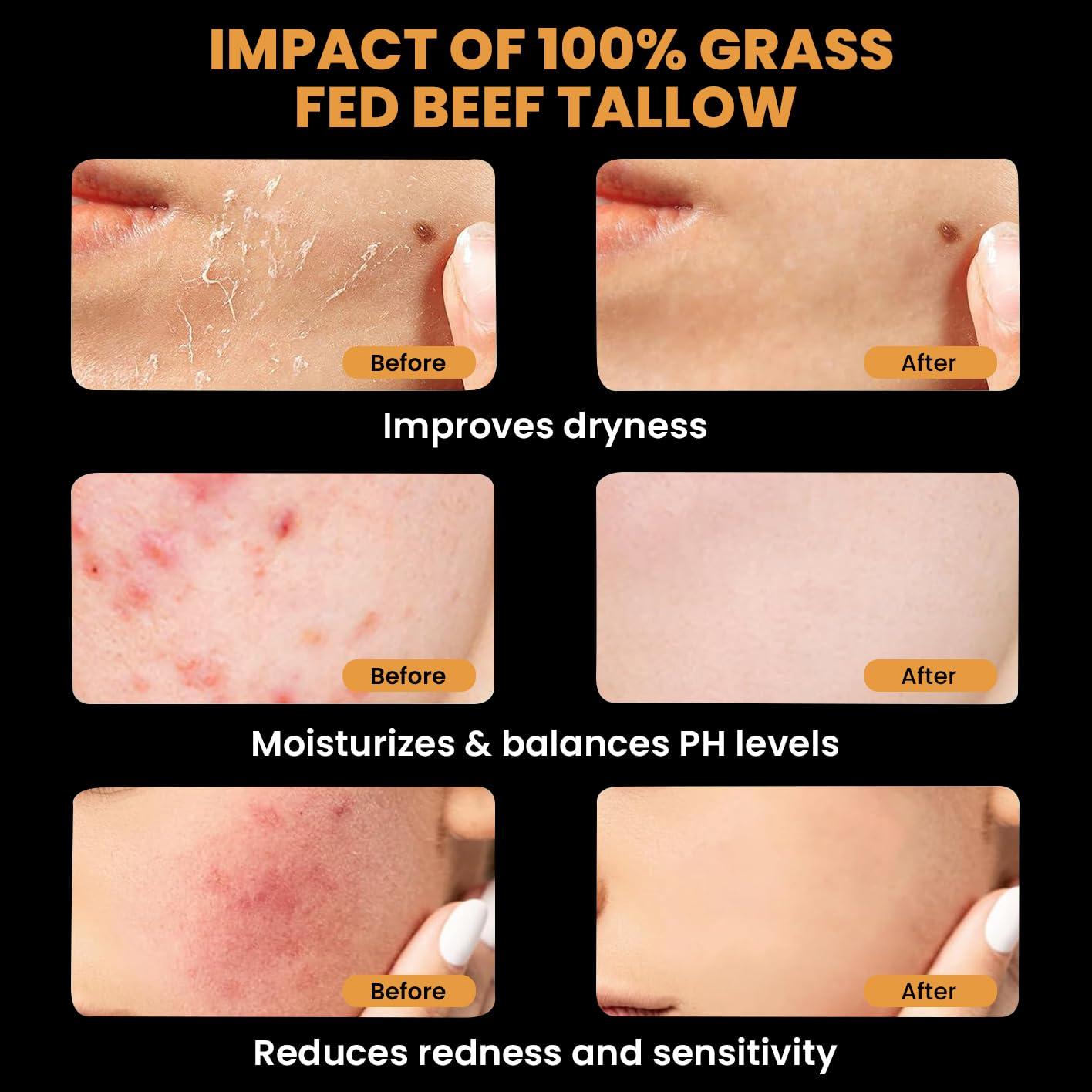 Bálsamo de Sebo y Miel MONIER 176g - Hidratante Natural Piel Seca