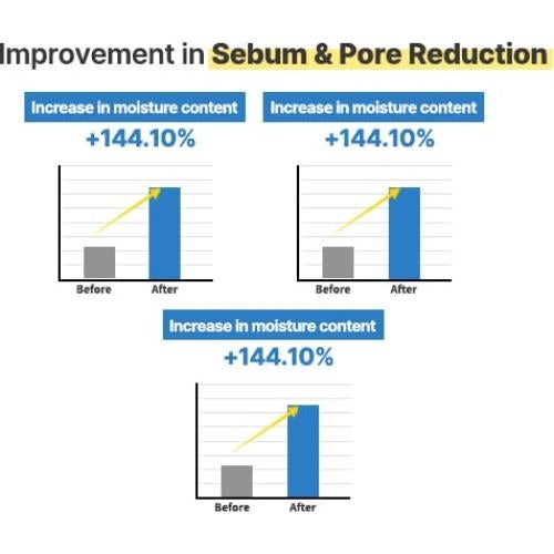 Sérum Facial Hidratante S.NATURE 50ml - Control de Sebo y Poros