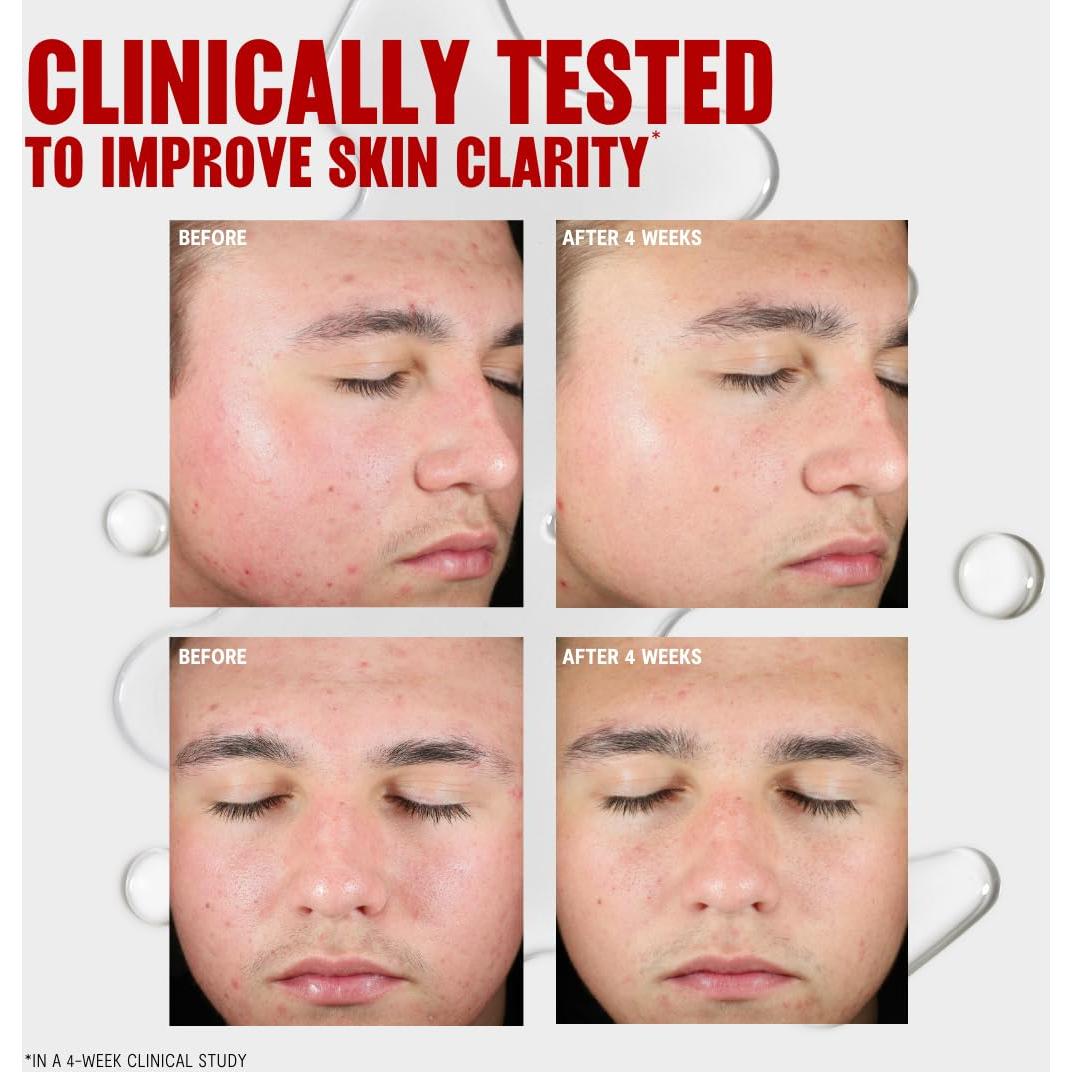 Tónico Facial Thayers para el Acné 354 ml con 2% Ácido Salicílico