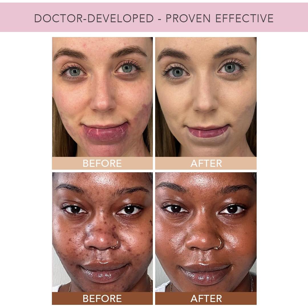 Base líquida hidratante Doll 10 TCE Liquid Filter 60g