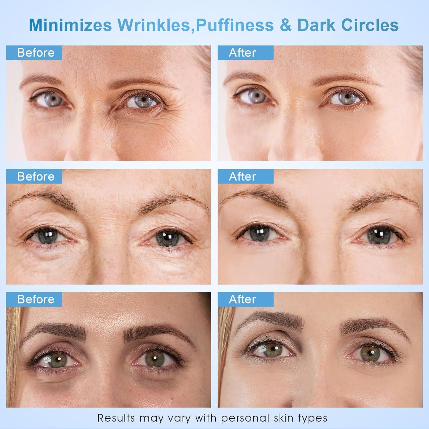 Crema para Ojos Anti-Envejecimiento Dongyu 68g con Mucina de Caracol