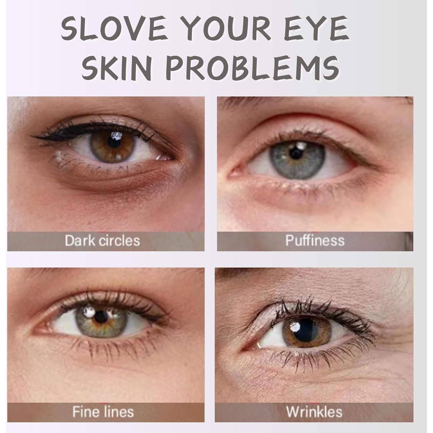 Crema para Ojos Evolvique Rosa Mosqueta 30ml Anti Arrugas