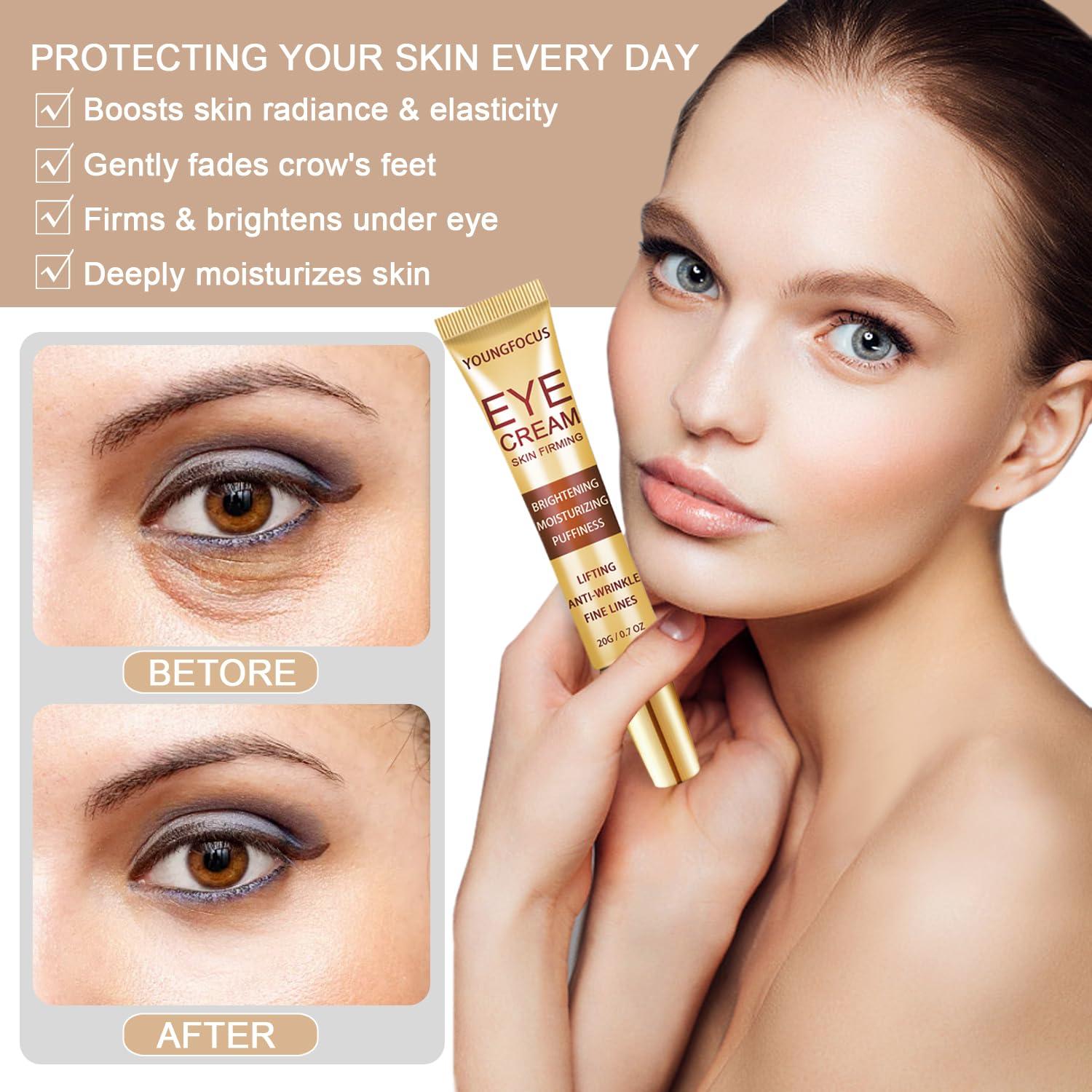 Crema para Ojos Anti Envejecimiento Youngfocus con Retinol 60g