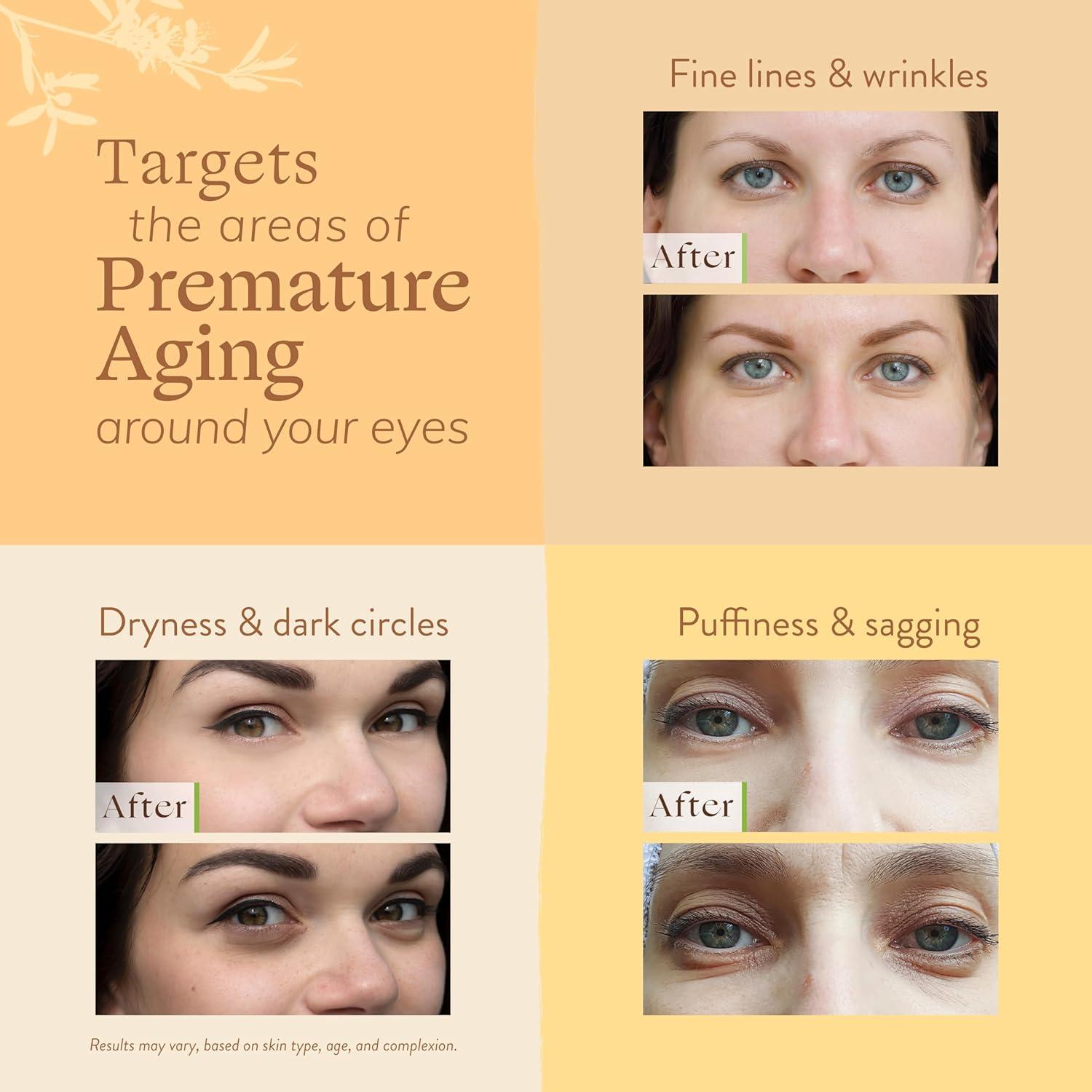 Crema para Ojos Lily Sado Citrus Kiss 28g - Antioxidantes y Péptidos