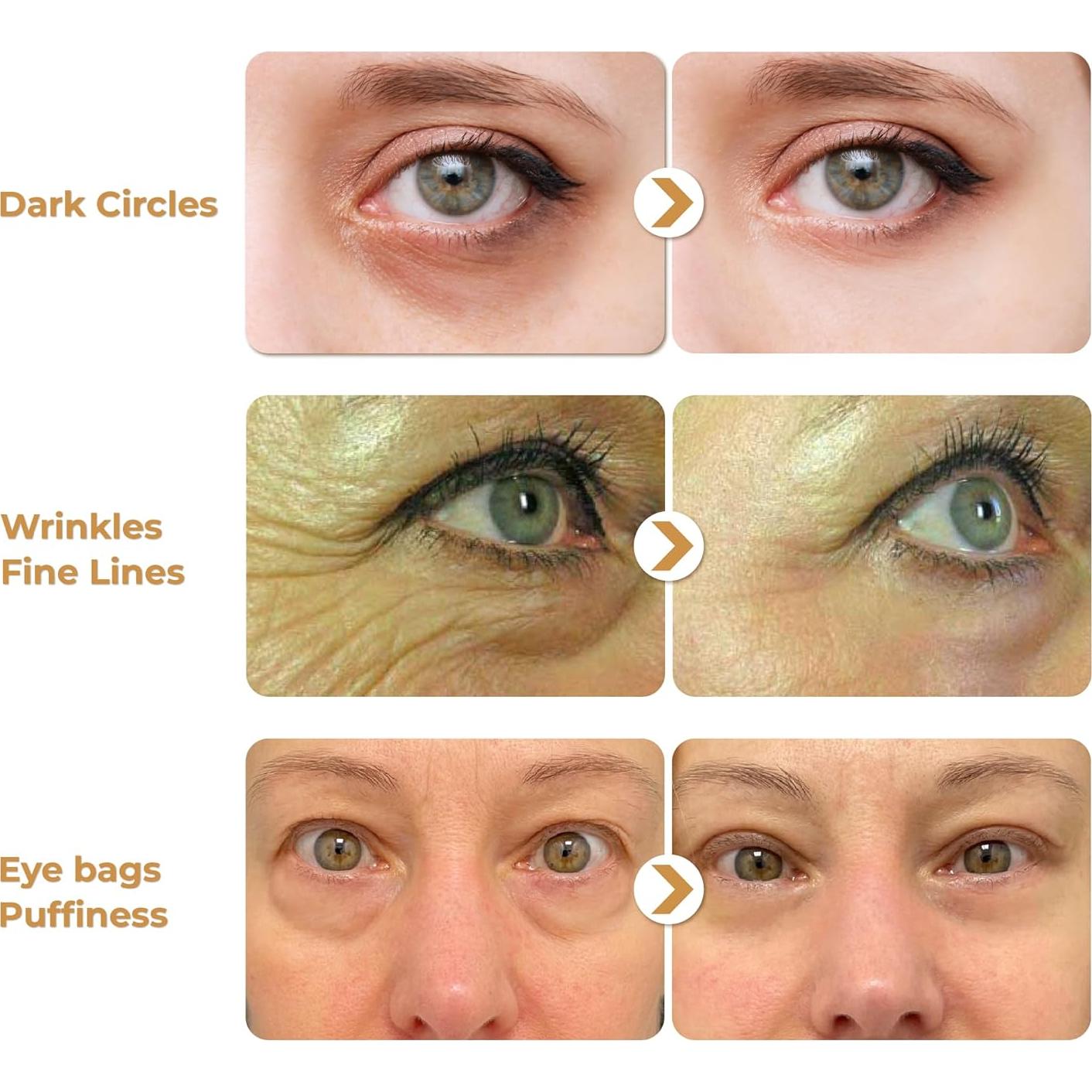 Crema para los Ojos ABERA 14.79 ml - Reduce Arrugas y Ojeras