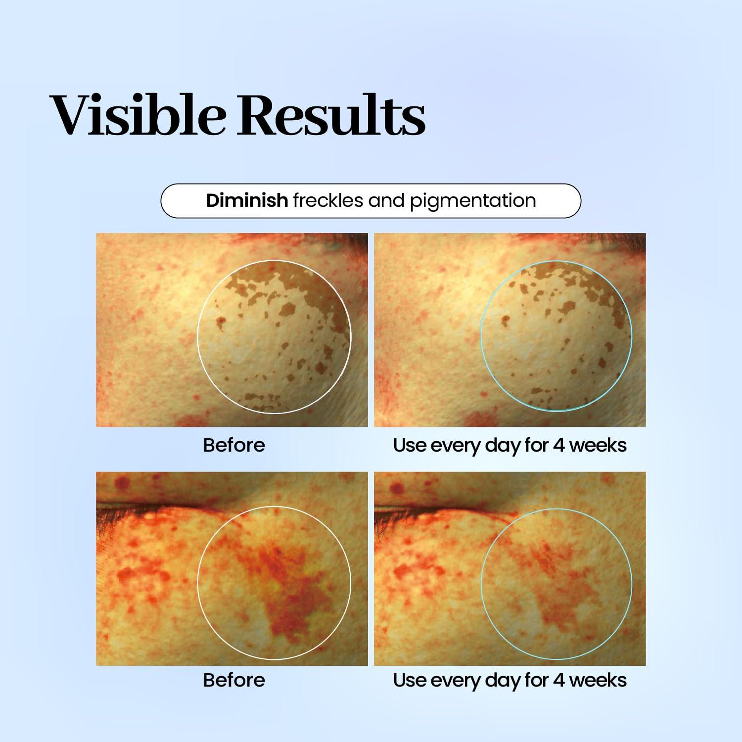 Parche Hidrogel Labottach para Manchas Oscuras - 32 Piezas