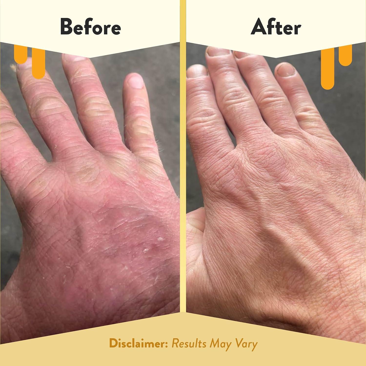 Jabón de Manos Espumoso Suave Eczema Honey 240 ml - Natural