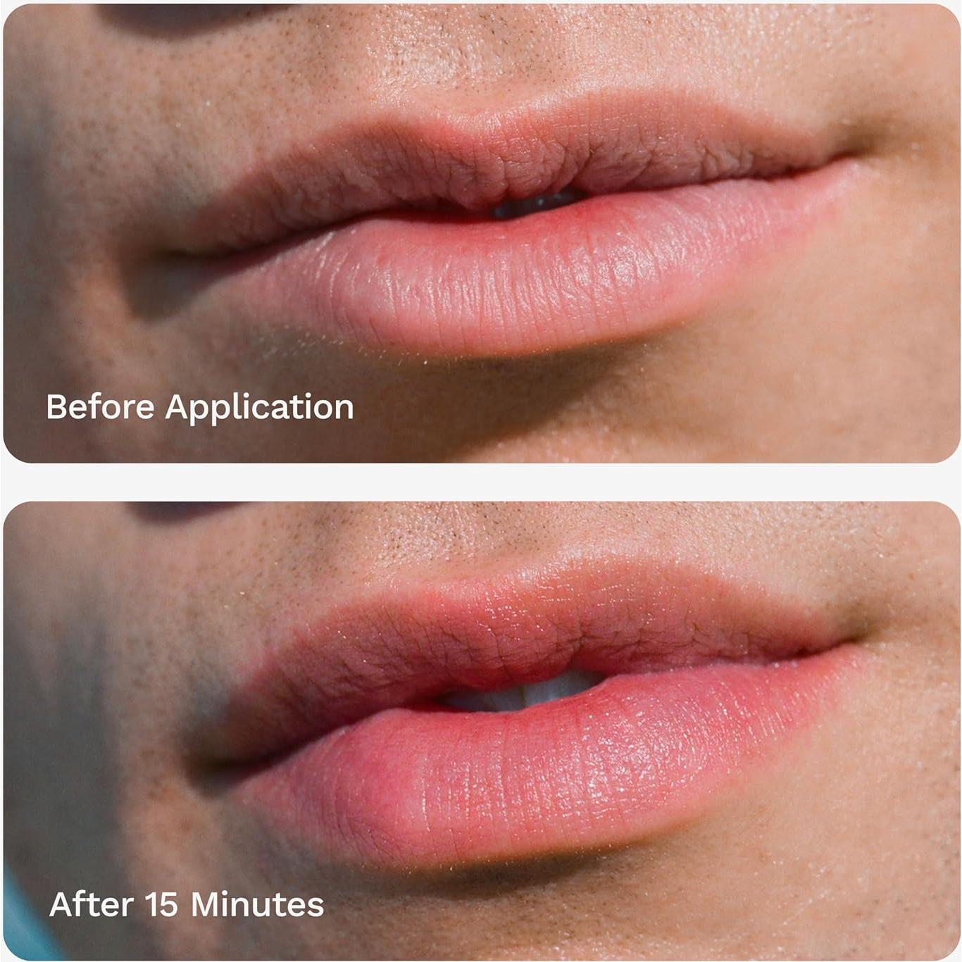 Chaddy Lip Plumper Mate Hidratante 15ml con Ácido Hialurónico