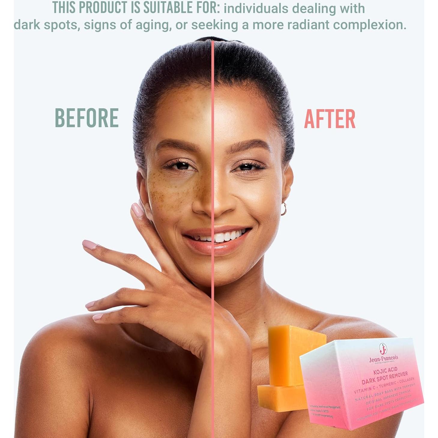 Jabones Jean-Francois para Manchas Oscuras con Ácido Kójico y Vitamina C - 2 Paquetes
