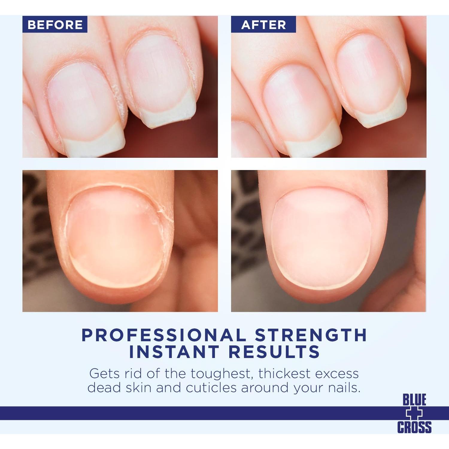 Removedor de Cutículas Líquido Blue Cross 170ml - Suavizante Profesional