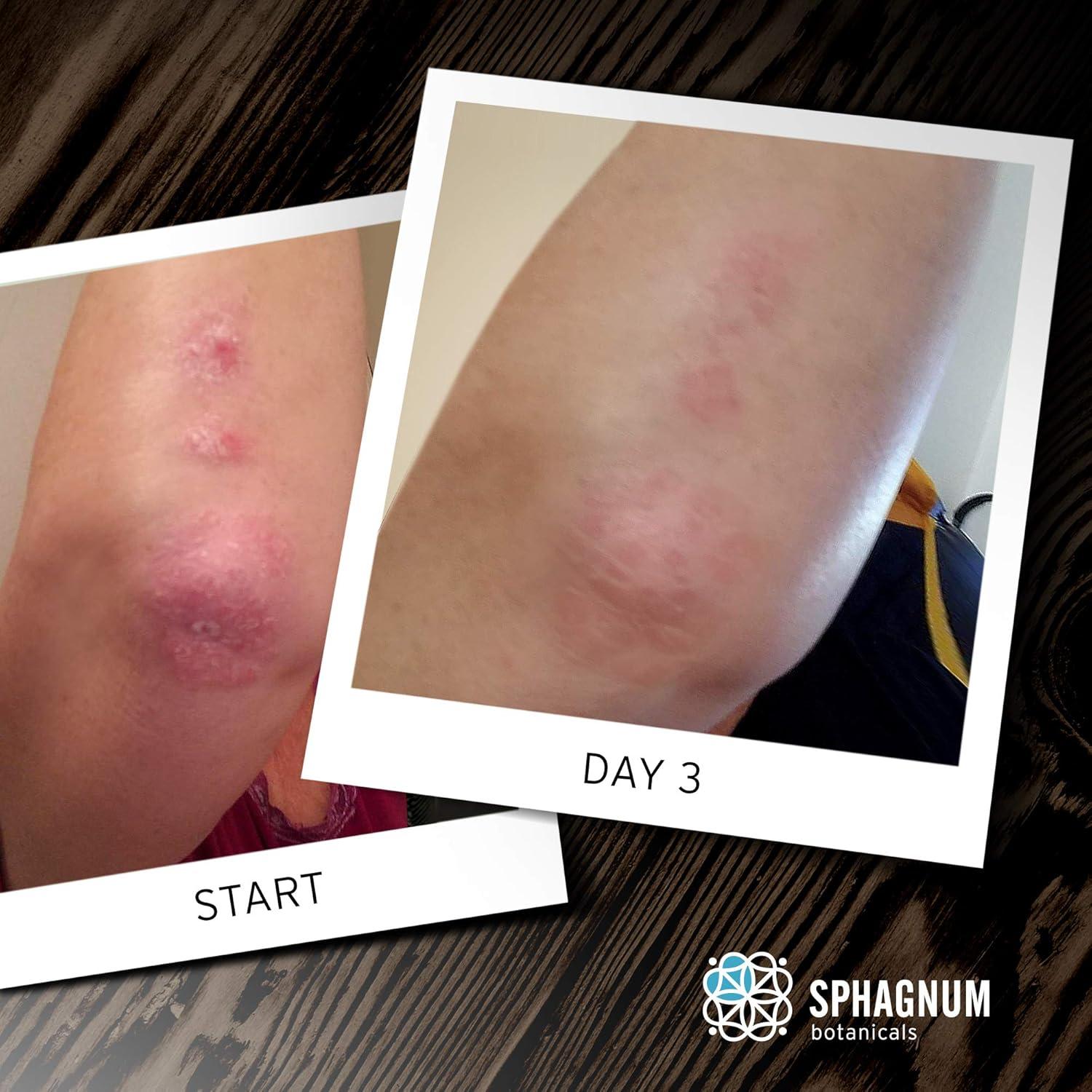 Jabón Corporal Natural Sphagnum 399.5 ml para Psoriasis y Eczema