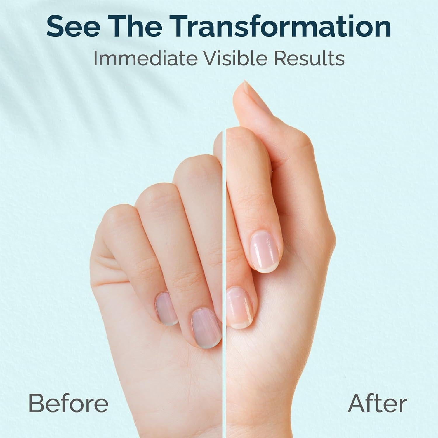 Crema Tratamiento Cutículas y Uñas ZMOI 28.35 g Hidratante