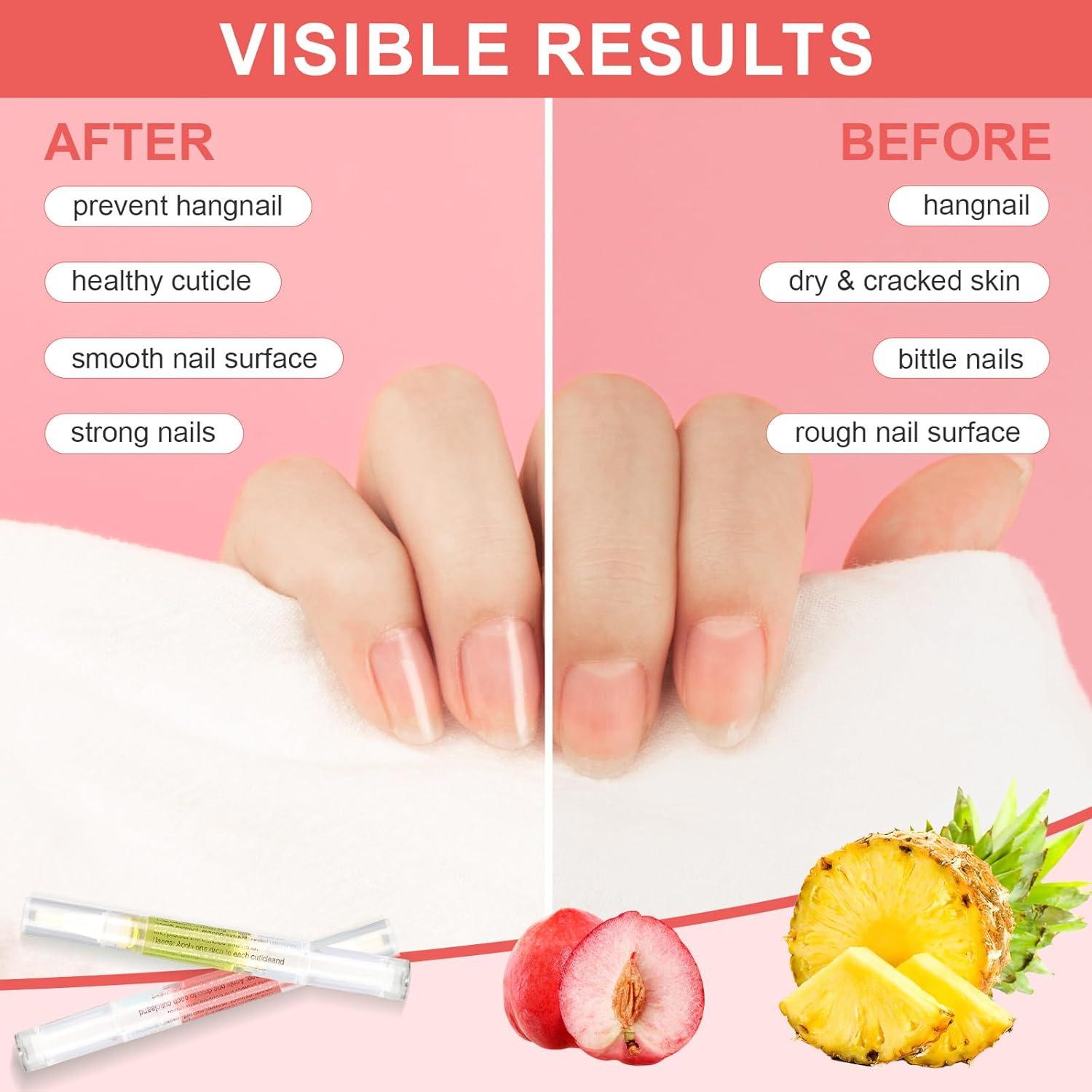 Bolígrafos de Aceite para Cutículas Meschett - 3 Piezas