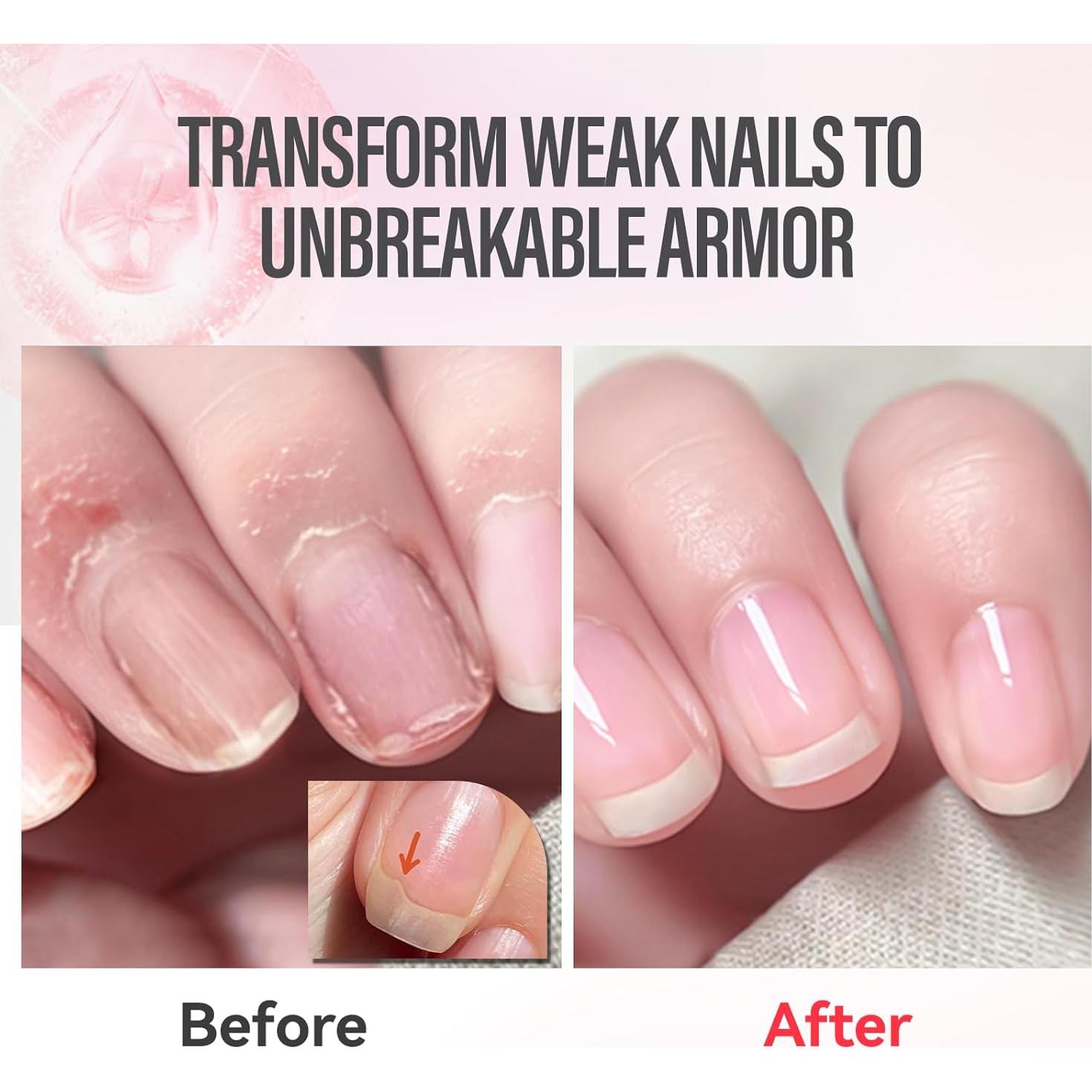 Aceite para Cutículas Chuchu - Fortalecedor Natural Sandía