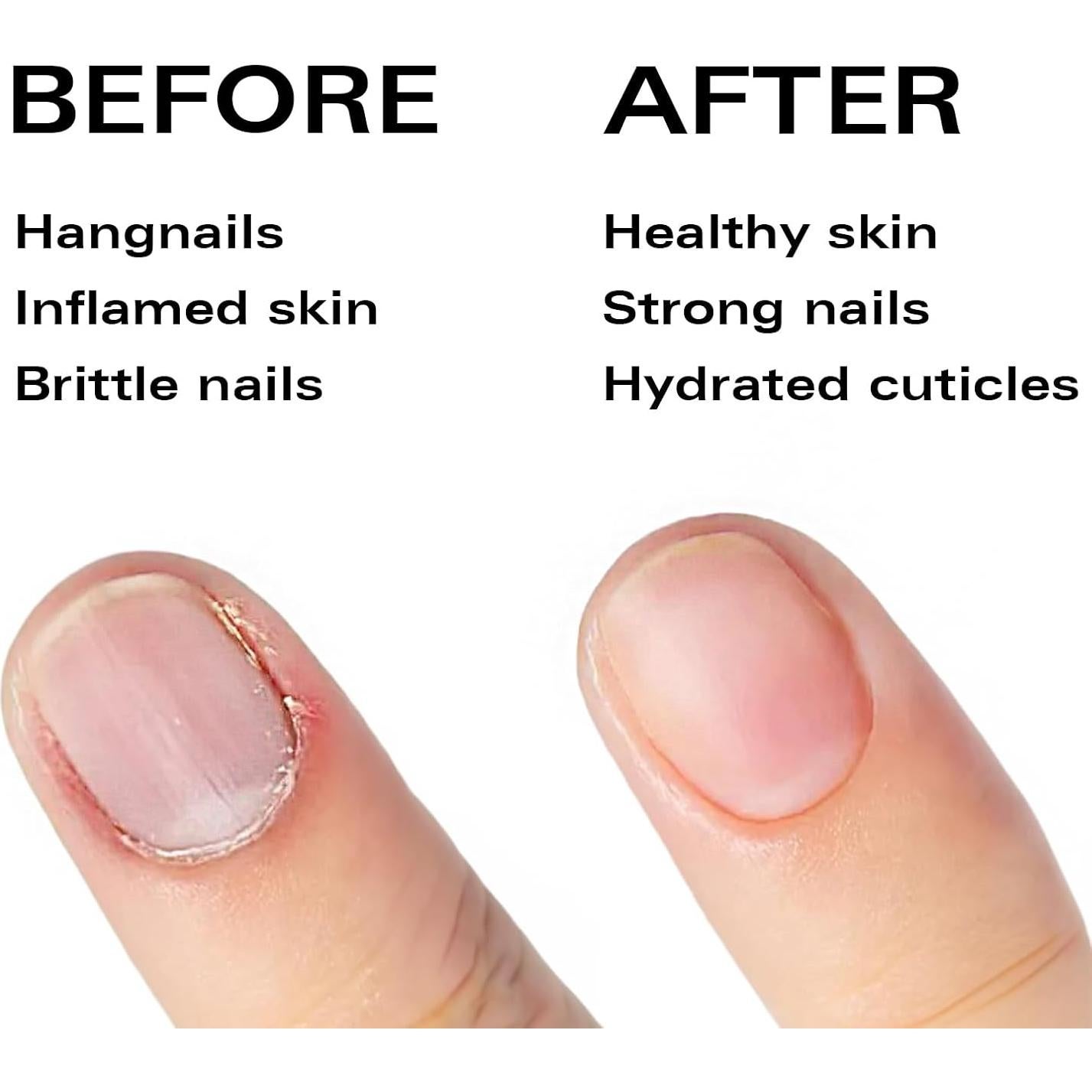 Bolígrafo de Aceite para Cutículas Beauty Power - Fresa, Fortalecedor de Uñas con Vitamina E