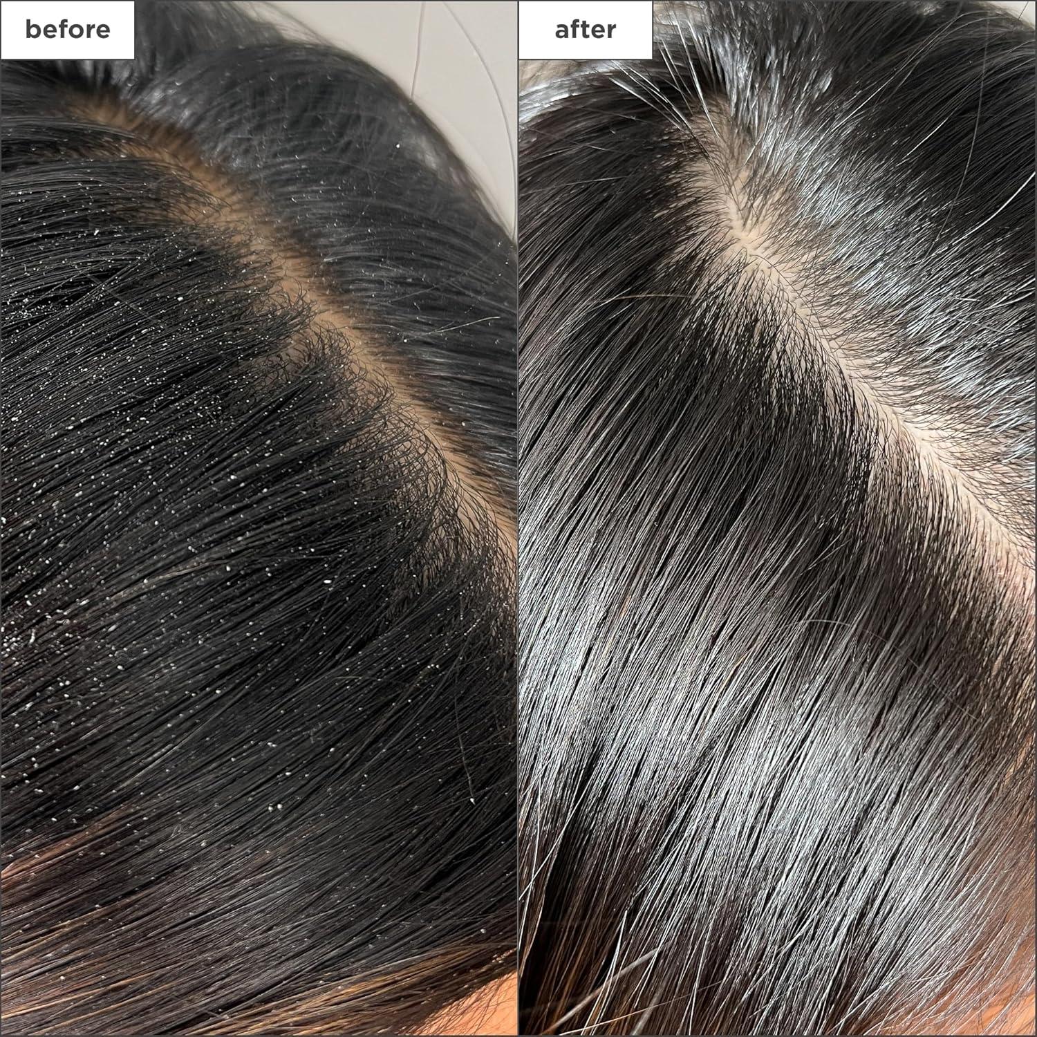 Spray Detox Briogeo 118 ml - Tratamiento Cuero Cabelludo